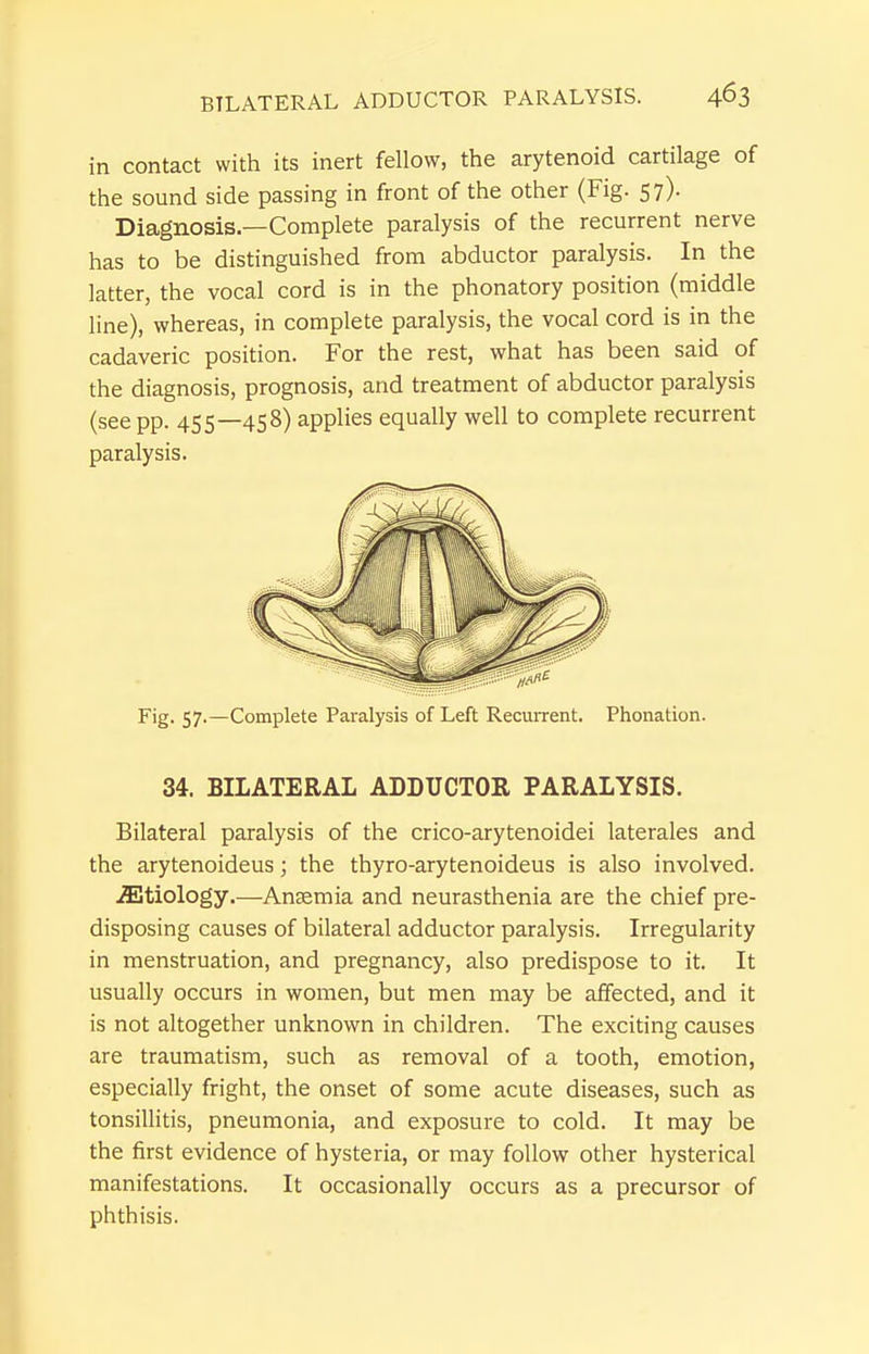 in contact with its inert fellow, the arytenoid cartilage of the sound side passing in front of the other (Fig. 57). Diagnosis—Complete paralysis of the recurrent nerve has to be distinguished from abductor paralysis. In the latter, the vocal cord is in the phonatory position (middle line), whereas, in complete paralysis, the vocal cord is in the cadaveric position. For the rest, what has been said of the diagnosis, prognosis, and treatment of abductor paralysis (see pp. 455—458) applies equally well to complete recurrent paralysis. Fig. 57.—Complete Paralysis of Left Recurrent. Phonation. 34. BILATERAL ADDUCTOR PARALYSIS. Bilateral paralysis of the crico-arytenoidei laterales and the arytenoideus; the thyro-arytenoideus is also involved. etiology.—Anaemia and neurasthenia are the chief pre- disposing causes of bilateral adductor paralysis. Irregularity in menstruation, and pregnancy, also predispose to it. It usually occurs in women, but men may be affected, and it is not altogether unknown in children. The exciting causes are traumatism, such as removal of a tooth, emotion, especially fright, the onset of some acute diseases, such as tonsillitis, pneumonia, and exposure to cold. It may be the first evidence of hysteria, or may follow other hysterical manifestations. It occasionally occurs as a precursor of phthisis.