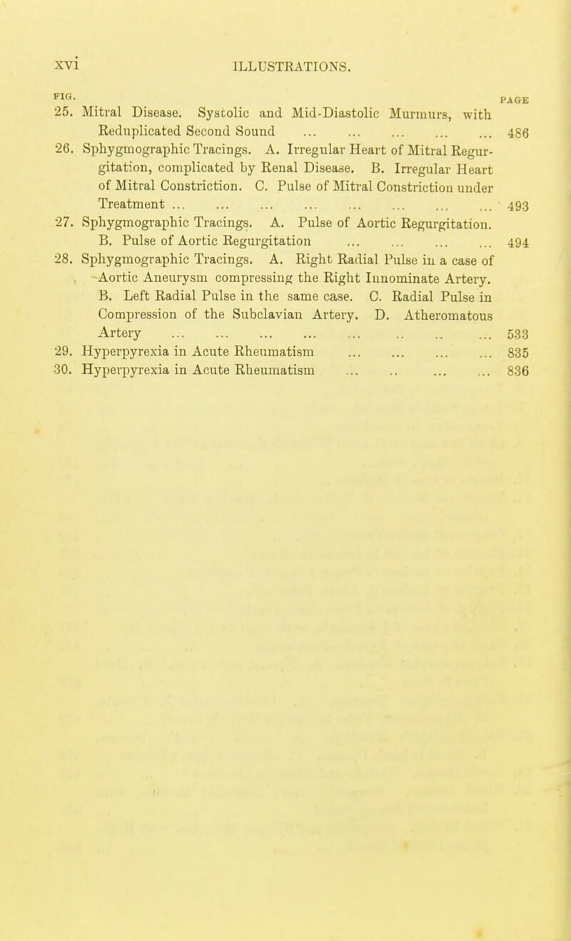 25. Mitral Disease. Systolic and Mid-Diastolic Murmurs, with Reduplicated Second Sound 486 26. Sphygmographic Tracings. A. Irregular Heart of Mitral Regur- gitation, complicated by Renal Disease. B. Irregular Heart of Mitral Constriction. C. Pulse of Mitral Constriction under Treatment ... ... ... ... ... ... ... ... 49.3 27. Sphygmographic Tracings. A. Pulse of Aortic Regurgitation. B. Pulse of Aortic Regurgitation ... ... ... ... 494 28. Sphygmographic Tracings. A. Right Radial Pulse in a case of Aortic Aneurysm compressing the Right Innominate Artery. B. Left Radial Pulse in the same case. C. Radial Pulse in Compression of the Subclavian Artery. D. Atheromatous Artery 533 29. Hyperpyrexia in Acute Rheumatism ... ... ... ... 835 30. Hyperpyrexia in Acute Rheumatism 836