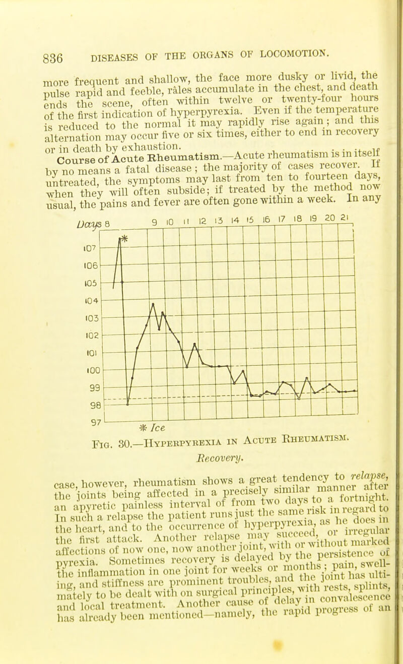 more frequent and shallow, the face more dusky or lividI, the muse rapid and feeble, rales accumulate m the chest and death Jnds the scene, often within twelve or twenty-four hours of ?he tot inchcation of hyperpyrexia. Even if the temperature is reduced to the normal it may rapidly rise again ; and this alternation may occur five or six times, either to end in recovery by no means a fatal disease; the majority of cases recover H untreated the symptoms may last from ten to fourteen dajs, Sen they will often subside; if treated by the method now usual, the pains and fever are often gone within a week. In any Days 8 9 ,0 .1 12 13 14 15 16 17 18 19 20 2' * Ice Fig. 30.—Hyperpyrexia in Acute Khetjmatism. Recovery. case, however, rheumatism shows a.great ^^^S!i the oints ^ing affected in a precisely'J^^^f^t^L Sections of now one, now another joint with J^SSrtSSrS pyrexia. Sometimes recovery is delayed by the Pp^^n SweS- ?£ inflammation in one joint teg^J^jjffi^ ins, and stiffness are prominent troubles, and tM mftely to be dealt with on y^;fffi5 and local treatment. Another cause of de ay in eon has already been mentioned—namely, the iapid piogiess