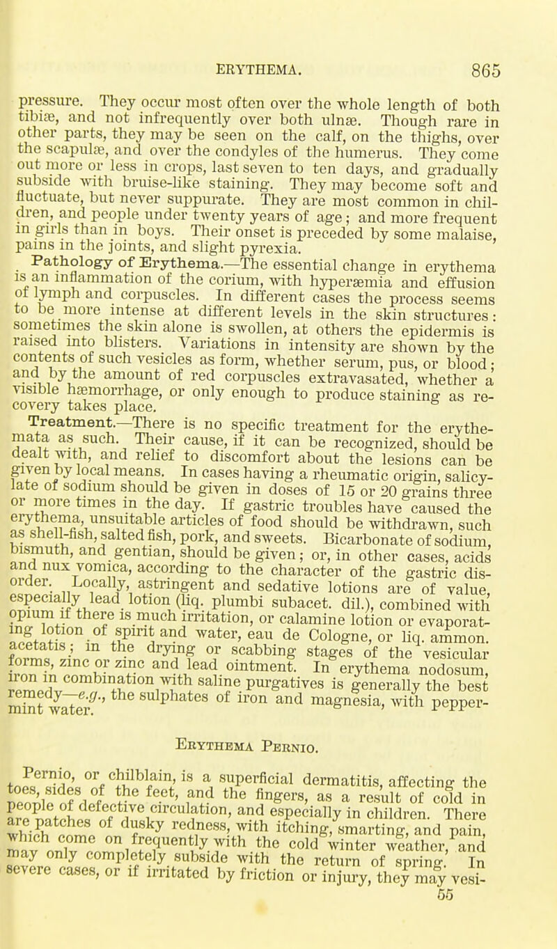 pressure. They occur most often over the whole length of both tibiae, and not infrequently over both ulnae. Though rare in other parts, they may be seen on the calf, on the thighs, over the scapulas, and over the condyles of the humerus. They come out more or less in crops, last seven to ten days, and gradually subside with bruise-like staining. They may become soft and fluctuate, but never suppurate. They are most common in chil- dren, and people under twenty years of age; and more frequent in girls than in boys. Their onset is preceded by some malaise, pains m the joints, and slight pyrexia. Pathology of Erythema.—The essential change in erythema is an inflammation of the corium, with hypersemia and effusion ol lymph and corpuscles. In different cases the process seems to be more intense at different levels in the skin structures • sometimes the skin alone is swoUen, at others the epidermis is raised mto blisters. Variations in intensity are shown by the contents of such vesicles as form, whether serum, pus, or blood • a?9, ,by.the amount of red corpuscles extravasated, whether a visible haemorrhage, or only enough to produce staining as re- covery takes place. Treatment.—There is no specific treatment for the eiwthe- niata as such. Their cause, if it can be recognized, should be dealt with, and rehef to discomfort about the lesions can be given by local means. In cases having a rheumatic origin, salicy- late of sodium should be given in doses of 15 or 20 grains three or more times m the day. If gastric troubles have caused the erythema unsuitable articles of food should be withdrawn, such as shell-fish salted fish, pork, and sweets. Bicarbonate of sodium, bismuth, and gentian, should be given; or, in other cases, acids and nux vomica, according to the character of the gastric dis- order. Locally astringent and sedative lotions are of value, especially lead lotion (liq. plumbi subacet. dil.), combined with opium rf there is much irritation, or calamine lotion or evaporat- ZV^l™- Tn\&nd water>eau de Cologne, or liq. ammon. fZv^ lU J * dryY¥ °I scabbing stages of the vesicular foims, zinc or zinc and lead ointment. In erythema nodosum mm in combination with saline purgatives is generally the best S waleT' °f ir°Q and ™«™*»> ^ith pepper- Erythema Pernio. L^fe0°^CJ?biaill,iS % 8£Perflcial dermatitis, affecting the El*nf ruLt & ^ ^ aS a reSult <>f Cold in tic %cumulation, and especially in children. There are patches of dusky redness, with itching, smarting, and pain may only completely subside with the return of spring In eevere cases, or if irritated by friction or injury, they may vesU