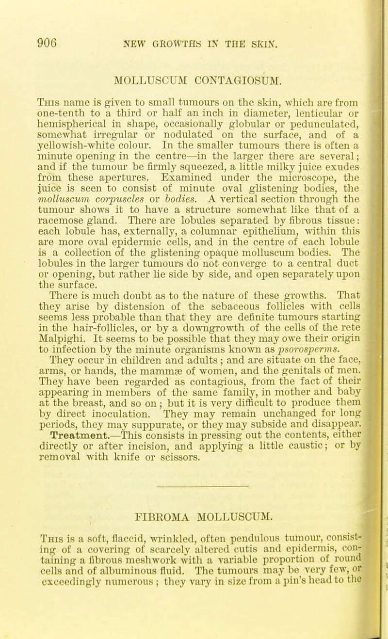 MOLLUSCUM CONTAGIOSUM. This name is given to small tumours on the skin, which are from one-tenth to a third or half an inch in diameter, lenticular or hemispherical in shape, occasionally globular or pedunculated, somewhat irregular or nodulated on the surface, and of a yellowish-white colour. In the smaller tumours there is often a minute opening in the centre—in the larger there are several; and if the tumour be firmly squeezed, a little milky juice exudes from these apertures. Examined under the microscope, the juice is seen to consist of minute oval glistening bodies, the molluscum corpuscles or bodies. A vertical section through the tumour shows it to have a structure somewhat like that of a racemose gland. There are lobules separated by fibrous tissue: each lobule has, externally, a columnar epithelium, within this are more oval epidermic cells, and in the centre of each lobule is a collection of the glistening opaque molluscum bodies. The lobules in the larger tumours do not con verge to a central duct or opening, but rather lie side by side, and open separately upon the surface. There is much doubt as to the nature of these growths. That they arise by distension of the sebaceous follicles with cells seems less probable than that they are definite tumours starting j in the hair-follicles, or by a downgrowth of the cells of the rete Malpighi. It seems to be possible that they may owe their origin j to infection by the minute organisms known as psorosperms. They occur in children and adults ; and are situate on the face, I arms, or hands, the mammae of women, and the genitals of men. | They have been regarded as contagious, from the fact of their appearing in members of the same family, in mother and baby I at the breast, and so on ; but it is very difficult to produce them by direct inoculation. They may remain unchanged for long I periods, they may suppurate, or they may subside and disappear. 1 Treatment.—This consists in pressing out the contents, either • directly or after incision, and applying a little caustic; or by I removal with knife or scissors. 1—— FIBROMA MOLLUSCUM. This is a soft, flaccid, wrinkled, often pendulous tumour, consist- ing of a covering of scarcely altered cutis and epidermis, con- taining a fibrous meshwork with a variable proportion of round cells and of albuminous fluid. The tumours may be very few, or exceedingly numerous ; they vary in size from a pin's head to the
