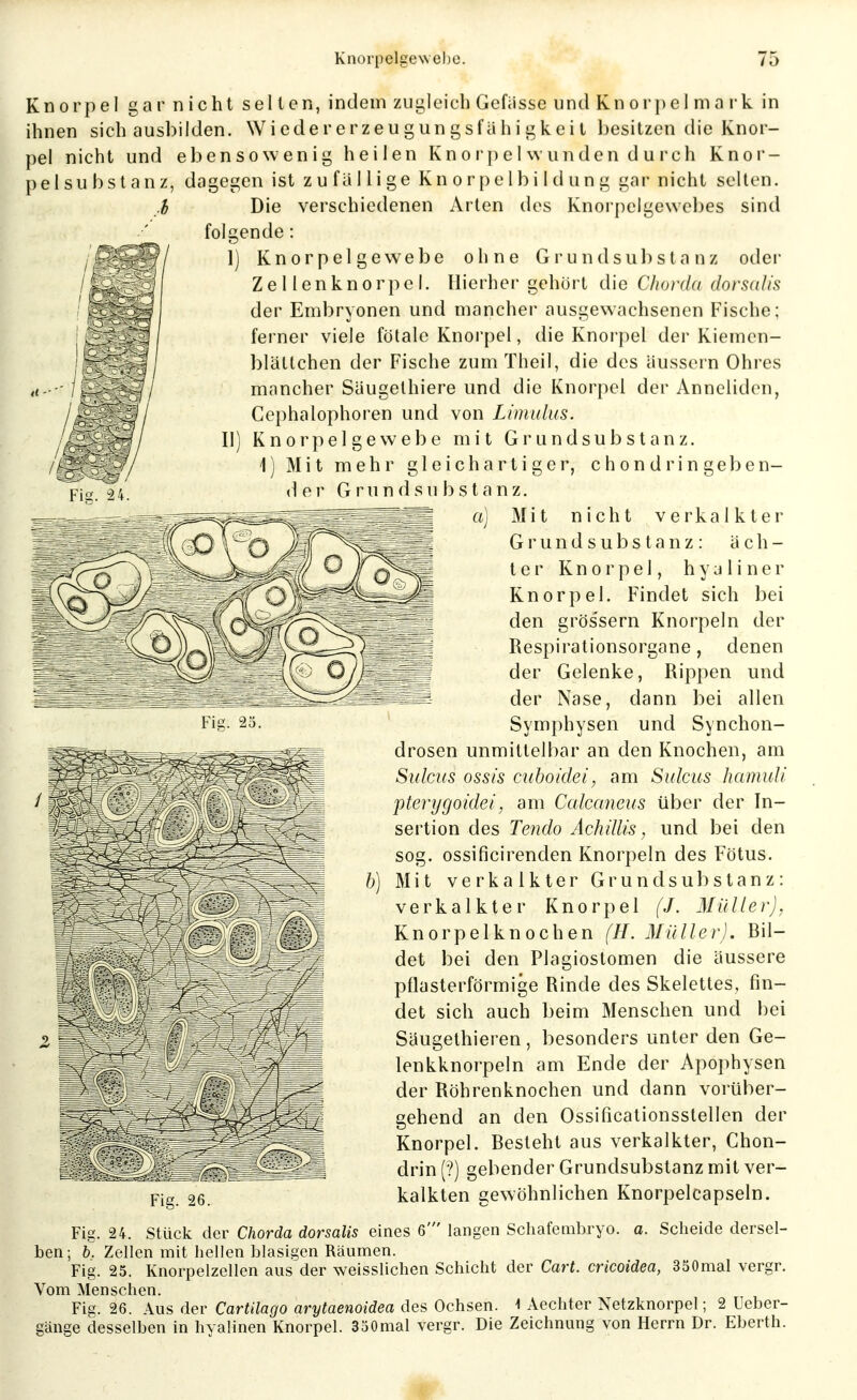Knorpel gar nicht selten, indem zugleich Gefiisse und Knorpel ma rk in ihnen sich ausbilden. Wiedererzeugungsfähigkeit besitzen die Knor- pel nicht und ebensowenig heilen Knorpel wunden durch Knor- pelsubstanz, dagegen ist zufallige Knorpelbildung gar nicht selten. verschiedenen Arten des Knorpelgewebes sind fol Die 'ende ^^^ f 1) Knorpelgewebe ohne G r u n d s u b s t a n z oder Zellenknorpel. Hierher gehört die Chorda clorsalis der Embryonen und mancher ausgewachsenen Fische; ferner viele fötale Knoi'pel, die Knorpel der Kiemen- blältchen der Fische zum Theil, die des äussern Ohres mancher Süugethiere und die Knorpel der Anneliden, Cephalophoren und von Limulus. K n 01^ p e l g e w e b e mit G r u n d s u b s t a n z. \] Mit mehr gleichartiger, c hon drin geben- de r G r u n d s u b s t a n z. a] Mit nicht verkalkter G r u n d s u b s t a n z : äch- ter Knorpel, hyaliner Knorpel. Findet sich bei den grös'sern Knorpeln der Respirationsorgane, denen der Gelenke, Rippen und der Nase, dann bei allen Symphysen und Synchon- drosen unmittelbar an den Knochen, am Sülms ossis cuhoidei, am Sidcus liamuli pterygoidei, am Calccmeus über der In- sertion des Tendo Ach Ulis ^ und bei den sog. ossificirenden Knorpeln des Fötus. Mit verkalkter Gr und Substanz: verkalkter Knorpel (J. Müller], Knorpelknochen (H. Müller). Bil- det bei den Plagiostomen die äussere pflasterförmige Rinde des Skelettes, fin- det sich auch beim Menschen und bei Säugethieren, besonders unter den Ge- lenkknorpeln am Ende der Apophysen der Röhrenknochen und dann vorüber- gehend an den Ossificationsslellen der Knorpel. Besteht aus verkalkter, Chon- drin (?) gebender Grundsubstanz mit ver- kalkten gewöhnlichen Knorpelcapseln. Fig. 24. Stück der Chorda dorsalis eines 6' langen Scliafembryo. a. Scheide dersel- ben; b. Zellen mit hellen blasigen Räumen. Fig. 25. Knorpelzellen aus der weisslichen Schicht der Cart. cricoidea, 350mal vergr. Vom Menschen. Fis. 26. Aus der Cartilago arytaenoidea des Ochsen. ^ Aechter Netzknorpel; 2 Ueber- gänge desselben in hyalinen Knorpel. 330mal vergr. Die Zeichnung von Herrn Dr. Eberth.