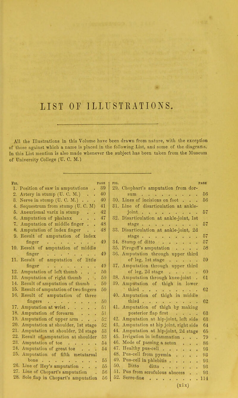 LIST or ILLUSTEATIONS. All the Illustrations in this Volume have been drawn from nature, with the exception of those against which a name is placed in the following List, and some of the diagrams. In this List mention is also made whenever the subject has been taken from the Museum of University College (U. C. M.l FlO. PAOE FIG. PAOB 1. Position of saw in amputations 39 29. Chophart's amputation from dor- 2. Artery in stump (U. C. M.) . . 40 56 3. Nerve in stump (U. C. M.) . . . 40 30. Lines of incisions on foot . . . 56 4. Sequestrum from stump (U. C. M) 41 31. Line of disarticulation at ankle- 5. Aneurismal varix in stump . . 42 57 6. Amputation of phalanx . . . 47 32. Disarticulation at ankle-joint, 1st 7. Amputation of middle finger . . 48 57 8. Amputation of index finger 48 33. Disarticulation at ankle-joint, 2d 9. Result of amputation of index 57 49 34. 57 10. Result of amputation of middle 35. Pirogolf's amputation .... 58 finger ........ 49 36. Amputation through upper third 11. Result of amputation of little 59 49 37. Amputation through upper third 12. Amputation of left thumb . . . 50 60 13. Amputation of right thumb . . 50 38. Amputation through knee-joint . 61 14. Result of amputation of thumb . 50 39. Amputation of thigh in lower 15. Result of amputation of two fingers 50 third 62 16. Result of amputation of three 40. Amputation of thigh in middle 50 third 62 51 41. Amputation of thigh by making 18. Amputation of forearm . . . 51 posterior flap first .... 63 19. Amputation of upper arm . . . 5-J 42. Amputation at hip-joint, left side 63 20. Amputation at shoulder, Ist stage 52 43. Amputation at hip joint, right side 64 21. Amputation at shoulder, 2d stage 53 44. Amputation at hip-joint, 2d stage 65 22. Result of, amputation at shoulder 53 45. Irrigation in inflammation . . . 79 28. Amputation of toe 54 46. Mode of passing a soton . . . 86 24. Amputation of great toe . . , 54 47. Healthy pus-cell 93 25. Amputation of fifth metatarsal 48. Pus-cell from pyemia .... 55 49. Pus-cell in phlebitis 93 26. Lino of Key's amputation . . . 55 50. Ditto ditto 93 27. Line of Chopart's amputation 56 51. Pus from scrofulous abscess . . 93 28. Sole flap in Chopart's amputation 5G 52. Serre-fiue IM (xixj