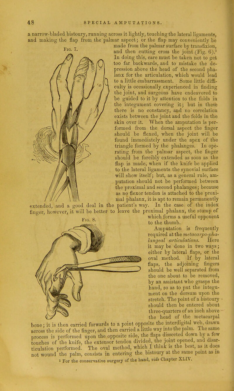 Fig. 7. a narrow-bladed bistoury, running across it lightly, touching the lateral ligaments, and making the flap from the palmar aspect; or the flap may conveniently he made from the palmar surface by transfixion, and then cutting cross the joint (Fig. 6).' In doing this, care must be taken not to get too far backwards, and to mistake the de- pression above the head of the second pha- lanx for the articulation, which would lead to a little embarrassment. Some little diffi- culty is occasionally experienced in finding the joint, and surgeons have endeavored to be guided to it by attention to the folds in the integument covering it; but in these there is no constancy, and no correlation exists between the joint and the folds in the skin over it. When the amputation is per- formed from the dorsal aspect the finger should be flexed, when the joint will be found immediately under the apex of the triangle formed by the phalanges. In ope- rating from the palmar aspect, the finger should be forcibly extended as soon as the flap is made, when if the knife be applied to the lateral ligaments the synovial surface will show itself; but, as a general rule, am- putation should not be performed between the proximal and second phalanges; because as no flexor tendon is attached to the proxi- mal phalanx, it is apt to remain permanently extended, and a good deal in the patient's way. In the case of the index finger, however, it will be better to leave the proximal phalanx, the stump of ^ which forms a useful opponent to the thumb. Amputation is frequently required at the metacarpo-jyha- langeal articidations. Here it may be done in two ways; either by lateral flaps, or the oval method. If by lateral flaps, the adjoining fingers should be well separated from the one about to be removed, by an assistant who grasps the hand, so as to put the integu- ment on the dorsum upon the stretch. The point of a bistoury should then be entered about three-quarters of an inch above the head of the metacarpal bone: it is then carried forwards to a point opposite the interdigitul web drawn across the side of the finger, and then carried a little way into the palm. 1 he same process is performed upon the opposite side, the flaps dissected down by a few touches of the knife, the extensor tendon divided, the joint opened, and disar- ticulation performed. The oval method, which I think is the best, as it does not wound the palm, consists in entering the bistoury at the same point as in 1 For tho oonsorvativo surgery of the hand, vide Chapter XLIV.