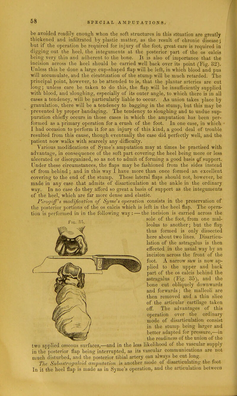 be avoided readily enough whon the soft structures in this situation are greatly thickened and infiltrated by plastic matter, as the result of chronic disease; but if the operation be required for injury of the foot, great care is required in digging out the heel, the integuments at the posterior part of the os calcis being very thin and adherent to the bone. It is also of importance that the incision across the heel should be carried well back over its point (Fig. 32). Unless this be done a large cup-shaped flap will be left, in which blood and pus will accumulate, and the cicatrization of the stump will be much retarded. The principal point, however, to be attended to is, that the plantar arteries are cut long; unless care be taken to do this, the flap will be insufiiciently supplied with blood, and sloughing, especially of its outer angle, to which there is in all cases a tendency, will be particularly liable to occur. As union takes place by granulation, there will be a tendency to bagging in the stump, but this may be prevented by proper bandaging. The tendency to sloughing and to undue sup- puration chiefly occurs in those cases in which the amputation has been per- formed as a primary operation for a crush of the foot. In one case, in which I had occasion to perform it for an injury of this kind, a good deal of trouble resulted from this cause, though eventually the case did perfectly well, and the patient now walks with scarcely any difficulty. Various modifications of Syme's amputation may at times be practised with advantage, in consequence of the soft part covering the heel being more or less ulcerated or disorganized, so as not to admit of forming a good basis gf support. Under these circumstances, the flaps may be fashioned from the sides instead of from behind; and in this way I have more than once formed an excellent covering to the end of the stump. These lateral flaps should not, however, be made in any case that admits of disarticulation at the ankle in the ordinary way. In no case do they afi'ord so great a basis of support as the integuments of the heel, which are far more dense and elastic. Pirogoff's modification of Syme's operation consists in the preservation of the posterior portions of the os calcis which is left in the heel flap. The opera- tion is performed in in the following way: — the incision is carried across the sole of the foot, from one nial- 'leolus to another; but the flap thus formed is only dissected here about two lines. Disarticu- lation of the astragalus is then efiected in the usual way by an incision across the front of the foot. A narrow saw is now ap- plied to the upper and back part of the os calcis behind the astragalus (Fig. 35), and the bone cut obliquely downwards and forwards; the malleoli are then romoved and a thin slice of the articular cartilage taken ofi. The advantages of this operation over the ordinary mode of disarticulation consist in the stump being larger and better adapted for pressure,—in the readiness of the union of the two applied osseous surfaces,—and in the less likelihood of the vascular supjily in the posterior flap being interrupted, as its vascular communications are not much disturbed, and the posterior tibial artery can always be cut long. The Subaslra(/<(loid amjmtation is another mode of disarticulating the foot In it the heel flap is made as in Syme's operation, and the articulation between