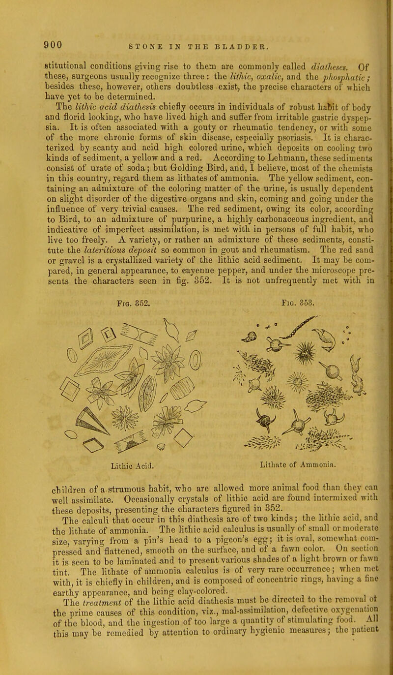 Btitutional conditions giving rise to them are commonly called diatJiescs. Of these, surgeons usually recognize three: the Nthic, oxalic, and the xthosj^halic ; besides these, however, others doubtless exist, the precise characters of which have yet to be determined. The lithic acid diathesis chiefly occurs in individuals of robust habit of body and florid looking, who have lived high and sufier from irritable gastric dyspep- sia. It is often associated with a gouty or rheumatic tendency, or with some of the more chronic forms of skin disease, especially psoriasis. It is charac- terized by scanty and acid high colored urine, which deposits on cooling two kinds of sediment, a yellow and a red. According to Lehmann, these sediments consist of urate of soda; but Golding Bird, and, I believe, most of the chemists in this country, regard them as lithates of ammonia. The yellow sediment, con- taining an admixture of the coloring matter of the urine, is usually dependent on slight disorder of the digestive organs and skin, coming and going under the influence of very trivial causes. The red sediment, owing its color, according to Bird, to an admixture of purpurine, a highly carbonaceous ingredient, and indicative of imperfect assimilation, is met with in persons of full habit, who live too freely. A variety, or rather an admixture of these sediments, consti- tute the lateritious deposit so common in gout and rheumatism. The red sand or gravel is a crystallized variety of the lithic acid sediment. It may be com- pared, in general appearance, to cayenne pepper, and under the microscope pre- sents the characters seen in fig. 352. It is not unfrequently met with in children of a strumous habit, who are allowed more animal food than they can well assimilate. Occasionally crystals of lithic acid are found intermixed with these deposits, presenting the characters figured in 352. The calculi that occur in this diathesis are of two kinds; the lithic acid, and the lithate of ammonia. The lithic acid calculus is usually of small or moderate size, varying from a pin's head to a pigeon's egg; it is oval, somewhat com- pressed and flattened, smooth on the surface, and of a fawn color. On section it is seen to be laminated And to present various shades of a light brown or fawn tint. The lithate of ammonia calculus is of very rare occurrence; when met with, it is chiefly in children, and is composed of concentric rings, having a fine earthy appearance, and being clay-colored. ■■ , , . The treatment of the lithic acid diathesis must be directed to the removal ot the prime causes of this condition, viz., mal-assimilation, defective oxygenation of the blood, and the ingestion of too large a quantity of stimulating food. All this may be remedied by attention to ordinary hygienic measures; the patient