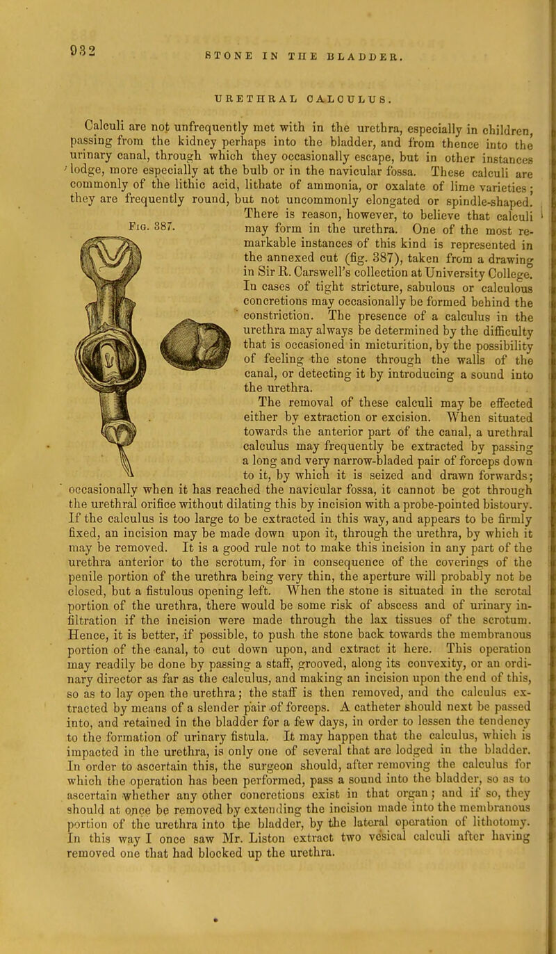 STONE IN THE BLADDER. TJRETnRAL CALCULUS, Fig. 387. Calculi are not unfrequently met with in the urethra, especially in children passing from the kidney perhaps into the bladder, and from thence into the urinary canal, through which they occasionally escape, but in other instances ' lodge, more especially at the bulb or in the navicular fossa. These calculi are commonly of the lithic acid, lithate of ammonia, or oxalate of lime varieties • they are frequently round, but not uncommonly elongated or spindle-shaped. There is reason, however, to believe that calculi may form in the urethra. One of the most re- markable instances of this kind is represented in the annexed cut (fig. 387), taken from a drawing in Sir R. Carswell's collection at University College. In cases of tight stricture, sabulous or calculous concretions may occasionally be formed behind the constriction. The presence of a calculus in the urethra may always be determined by the difficulty that is occasioned in micturition, by the possibility of feeling the stone through the walls of the canal, or detecting it by introducing a sound into the urethra. The removal of these calculi may be eflPected either by extraction or excision. When situated towards the anterior part of the canal, a urethral calculus may frequently be extracted by passing a long and very narrow-bladed pair of forceps down to it, by which it is seized and drawn forwards; occasionally when it has reached the navicular fossa, it cannot be got through the urethral orifice without dilating this by incision with a probe-pointed bistoury. If the calculus is too large to be extracted in this way, and appears to be firmly fixed, an incision may be made down upon it, through the urethra, by which it may be removed. It is a good rule not to make this incision in any part of the urethra anterior to the scrotum, for in consequence of the coverings of the penile portion of the urethra being very thin, the aperture will probably not be closed, but a fistulous opening left. When the stone is situated in the scrotal portion of the urethra, there would be some risk of abscess and of urinary in- filtration if the incision were made through the lax tissues of the scrotum. Hence, it is better, if possible, to push the stone back towards the membranous portion of the canal, to cut down upon, and extract it here. This operation may readily be done by passing a staff, grooved, along its convexity, or an ordi- nary director as far as the calculus, and making an incision upon the end of this, so as to lay open the urethra; the staff is then removed, and the calculus ex- tracted by means of a slender pair of forceps. A catheter should next be passed into, and retained in tho bladder for a few days, in order to lessen tlie tendency to the formation of urinary fistula. It may happen that the calculus, whicli is impacted in the urethra, ia only one of several that are lodged in the bladder. In order to ascertain this, the surgeon should, after removing the calculus for which the operation has been performed, pass a sound into the bladder, so as to ascertain whether any other concretions exist in that organ; and if so, they should at once bp removed by extemling the incision made into the membranous portion of the urethra into the bladder, by tlie lateral operation of lithotomy. In this way I once saw Mr. Liston extract two vesical calculi after having removed one that had blocked up the urethra.