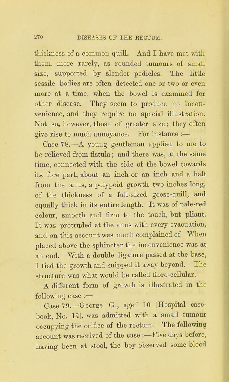 thickness of a common quill. And I have met with them, more rarely, as rounded tumours of small size, supported hy slender pedicles. The little sessile bodies are often detected one or two or even more at a time, when the bowel is examined for other disease. They seem to produce no incon- venience, and they require no special illustration. Not so, however, those of greater size ; they often give rise to much annoyance. For instance :— Case 78.—A young gentleman applied to me to be relieved from fistula; and there was, at the same time, connected with the side of the bowel towards its fore part, about an inch or an inch and a half from the anus, a polypoid growth two inches long, of the thickness of a full-sized goose-quill, and equally thick in its entire length. It was of pale-red colour, smooth and firm to the touch, but pliant. It was protruded at the anus with every evacuation, and on this account was much complained of. When placed above the sphincter the inconvenience was at an end. With a double ligature passed at the base, I tied the growth and snipped it away beyond. The structure was what would be called fibro-cellular. A different form of growth is illustrated in the following case :— Case 79.—George G., aged 10 [Hospital case- book, No. 12], was admitted with a small tumour occupying the orifice of the rectum. The following account was received of the case :—Five days before, having been at stool, the boy observed some blood