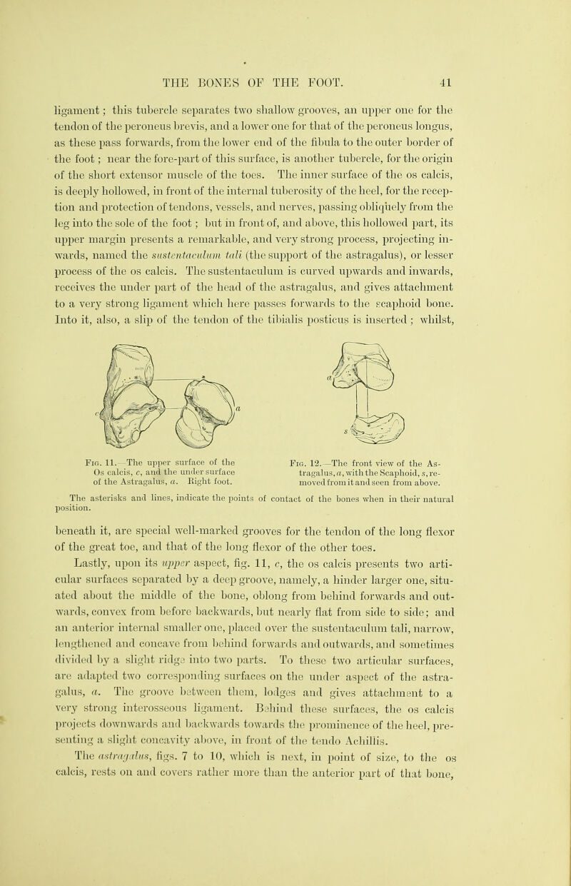 ligament; this tubercle separates two shallow grooves, an upper one for the tendon of the peroneus brevis, and a lower one for that of the peroneus longus, as these pass forwards, from the lower end of the fibula to the outer border of the foot; near the fore-part of this surface, is another tubercle, for the origin of the short extensor muscle of the toes. The inner surface of the os calcis, is deeply hollowed, in front of the internal tuberosity of the heel, for the recep- tion and protection of tendons, vessels, and nerves, passing obliquely from the leg into the sole of the foot; but in front of, and above, this hollowed part, its upper margin presents a remarkable, and very strong process, projecting in- wards, named the sustentaculum tali (the support of the astragalus), or lesser process of the os calcis. The sustentaculum is curved upwards and inwards, receives the under part of the head of the astragalus, and gives attachment to a very strong ligament which here passes forwards to the scaphoid bone. Into it, also, a slip of the tendon of the tibialis posticus is inserted ; whilst, The asterisks and lines, indicate the points of contact of the bones when in their natural position. beneath it, are special well-marked grooves for the tendon of the long flexor of the great toe, and that of the long flexor of the other toes. Lastly, upon its upper aspect, fig. 11, c, the os calcis presents two arti- cular surfaces separated by a deep groove, namely, a hinder larger one, situ- ated about the middle of the bone, oblong from behind forwards and out- wards, convex from before backwards, but nearly flat from side to side; and an anterior internal smaller one, placed over the sustentaculum tali, narrow, lengthened and concave from behind forwards and outwards, and sometimes divided by a slight ridge into two parts. To these two articular surfaces, are adapted two corresponding surfaces on the under aspect of the astra- galus, a. The groove between them, lodges and gives attachment to a very strong interosseous ligament. Behind these surfaces, the os calcis projects downwards and backwards towards the prominence of the heel, pre- senting a slight concavity above, in front of the tendo Achillis. The astragalus, figs. 7 to 10, which is next, in point of size, to the os calcis, rests on and covers rather more than the anterior part of that bone, Fir. 11.—The upper surface of the Os calcis, c, and the under surface of the Astragalus, a. Eight foot. Fig. 12.—The front view of the As- tragalus, a, with the Scaphoid, s, re- moved from it and seen from above.