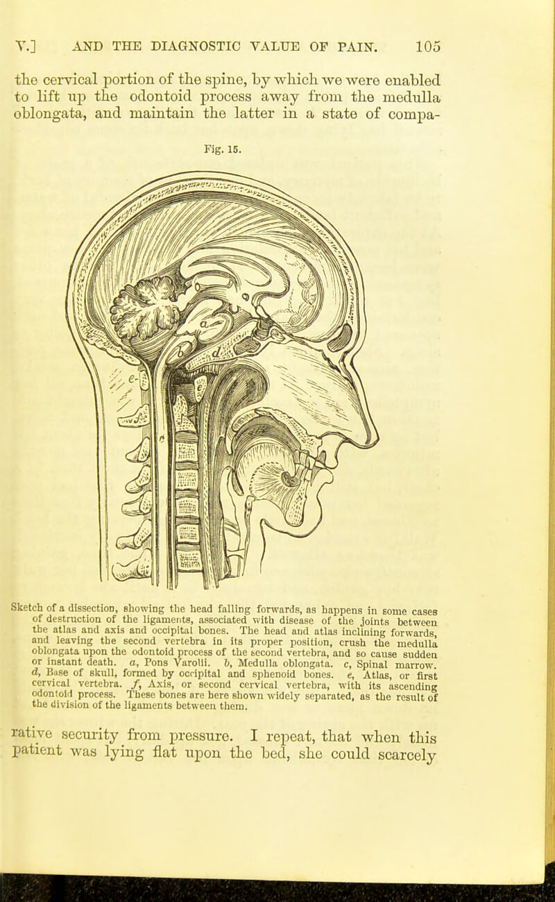 the cervical portion of the spine, by wliicli we were enabled to lift up the odontoid process away from the medulla oblongata, and maintain the latter in a state of compa- Fig. 15. Sketch of a dissection, ehowing the head falling forwards, as happens in some cases of destruction of the ligaments, associated with disease ot the joints between the atlas and axis and occipital bones. The head and atlas inclining forwards, and leaving the second vertebra in its proper position, crush the medulla oblongata upon the odontoid process of the tecond vertebra, and so cause sudden or instant death, a, Pons Varolii. Jj, Medulla oblongata, c, Spinal marrow. d. Base of skull, formed by occipital and sphenoid bones, e. Atlas, or first cervical vertebra. /, A.xis, or second cervical vertebra, with its ascending odontoid process. These bones are here shown widely separated, as the result of the division of the ligaments between them. rative security from pressure. I repeat, that when this patient was lying flat upon the bed, she could scarcely