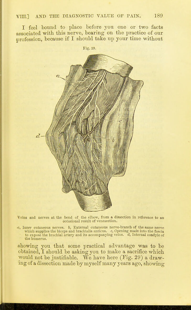 I feel bound to place before you one or two facts associated with this nerve, bearing on the practice of our profession, because if I should take up your time without Fig.29. Veins and nerves at the bend of the elbow, from a dissection in reference to an occasional result of venesection. ■a, Inner cutaneous nerves. 6, External cutaneous nerve-branch of the same nerve which supplies the biceps and brachlalis anticus. c, Opening made into the fascia to expose the brachial artery and its accompanying veins, d, Internal condyle of the humerus. showing you that some practical advantage was to be obtained, I should be asking you to make a sacrifice which would not be justifiable. We have here (Fig. 29) a draw- ing of a dissection made by myself many years ago, showing