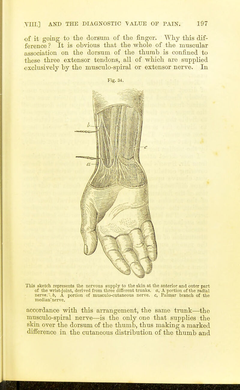 of it going to the dorsum of tlie finger. Wliy this dif- ference ? It is obvious that the whole of the muscular association on the dorsum of the thumb is confined to these three extensor tendons, all of which are supplied exclusively by the musculo-spiral or extensor nerve. In Fig. 34. This sketch represents the nervous supply to the skin at the anterior and outer part of the wrist-joint, derived from three different trunks, a, A portion of the radial nerve. , b, A portion of musculo-cutaneous nerve, c, Palmar branch of the median'nerve. accordance with this arrangement, the same trunk—the musculo-spiral nerve—is the only one that supplies the skin over the dorsum of the thumb, thus making a marked difference in the cutaneous distribution of the thumb and