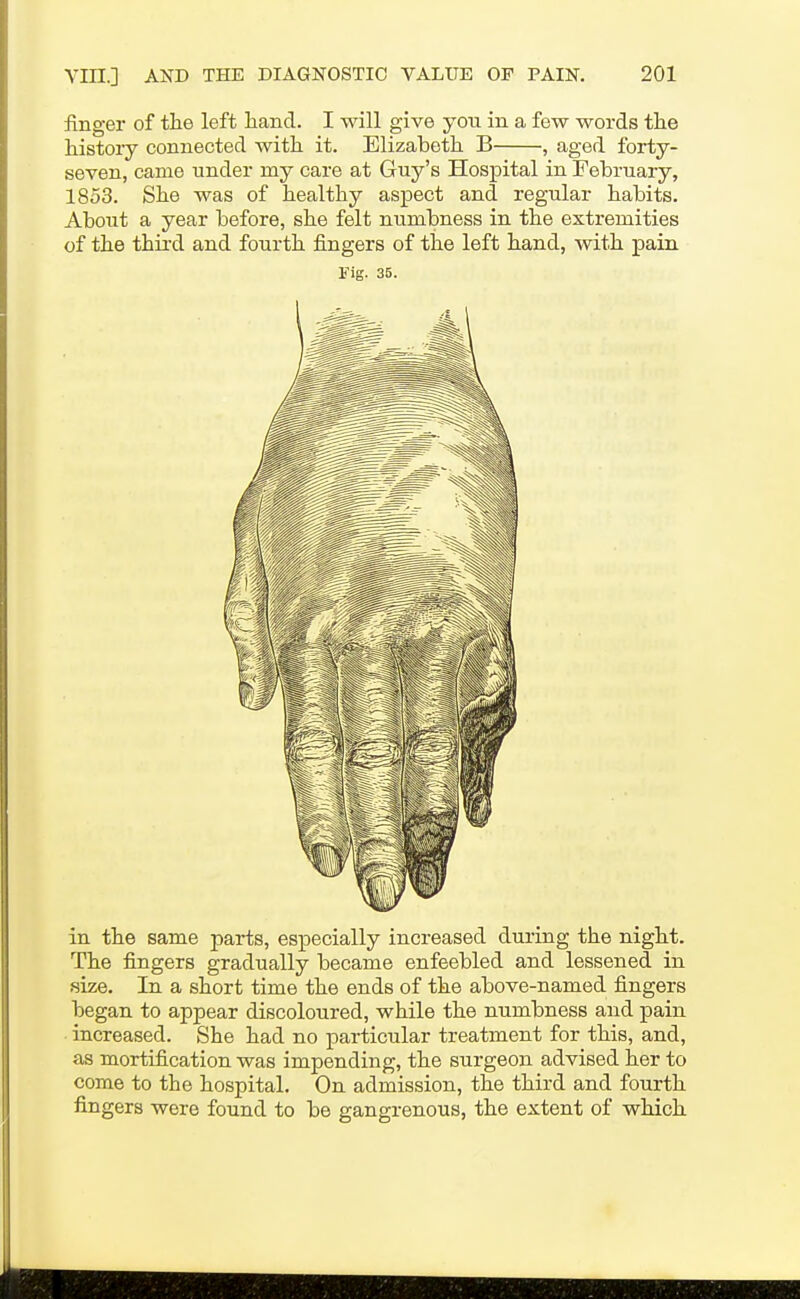 finger of the left hand. I will give you in a few words the history connected with it. Elizabeth B , aged forty- seven, came under my care at Guy's Hospital in February, 1853. She was of healthy aspect and regular habits. About a year before, she felt numbness in the extremities of the third and fourth fingers of the left hand, with pain Fig. 35. in the same parts, especially increased during the night. The fingers gradually became enfeebled and lessened in size. In a short time the ends of the above-named fingers began to appear discoloured, while the numbness and pain increased. She had no particular treatment for this, and, as mortification was impending, the surgeon advised her to come to the hospital. On admission, the third and fourth fingers were found to be gangrenous, the extent of which