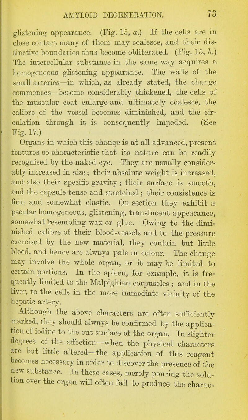 glistening appearance. (Fig. 15, a.) If the cells are in close contact many of them may coalesce, and their dis- tinctive boundaries thus become obliterated. (Fig. 15, b.) The intercellular substance in the same way acquires a homogeneous glistening appearance. The walls of the small arteries—in which, as already stated, the change commences—become considerably thickened, the cells of the muscular coat enlarge and ultimately coalesce, the calibre of the vessel becomes diminished, and the cir- culation through it is consequently impeded. (See Fig. 17.) ; Organs in which this change is at all advanced, present features so characteristic that its nature can be readily recognised by the naked eye. They are usually consider- ably increased in size ; their absolute weight is increased, and also their specific gravity ; their surface is smooth, and the capsule tense and stretched ; their consistence is firm and somewhat elastic. On section they exhibit a pecular homogeneous, glistening, translucent appearance, somewhat resembling wax or glue. Owing to the dimi- nished calibre of their blood-vessels and to the pressure exercised by the new material, they contain but little blood, and hence are always pale in colour. The change may involve the whole organ, or it may be limited to certain portions. In the spleen, for example, it is fre- quently limited to the Malpighian corpuscles ; and in the liver, to the cells in the more immediate vicinity of the hepatic artery. Although the above characters are often sufficiently marked, they should always be confirmed by the applica- tion of iodine to the cut surface of the organ. In slighter degrees of the affection—when the physical characters are but little altered—the application of this reagent becomes necessary in order to discover the presence of the new substance. In these cases, merely pouring the solu- tion over the organ will often fail to produce the charac-