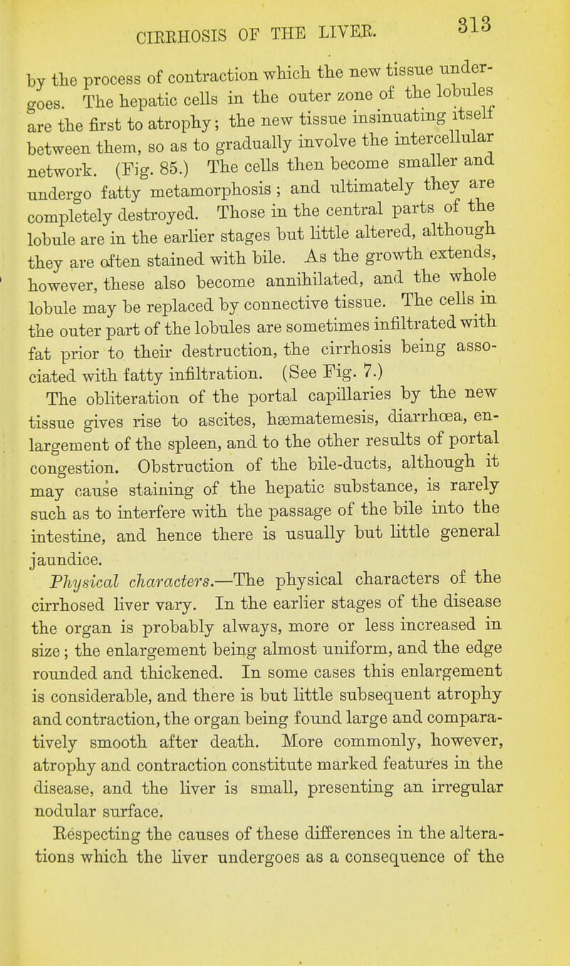 by the process of contraction which the new tissue under- goes. The hepatic cells in the onter zone of the lobules are the first to atrophy; the new tissue insinuating itsell between them, so as to gradually involve the intercellular network. (Fig. 85.) The cells then become smaller and undergo fatty metamorphosis ; and ultimately they are completely destroyed. Those in the central parts of the lobule are in the earlier stages but little altered, although they are often stained with bile. As the growth extends, however, these also become annihilated, and the whole lobule may be replaced by connective tissue. The cells in the outer part of the lobules are sometimes infiltrated with fat prior to their destruction, the cirrhosis being asso- ciated with fatty infiltration. (See Fig. 7.) The obliteration of the portal capillaries by the new tissue gives rise to ascites, heematemesis, diarrhoea, en- largement of the spleen, and to the other results of portal congestion. Obstruction of the bile-ducts, although it may cause staining of the hepatic substance, is rarely such as to interfere with the passage of the bile into the intestine, and hence there is usually but little general jaundice. Physical characters—The physical characters of the cirrhosed liver vary. In the earlier stages of the disease the organ is probably always, more or less increased in size; the enlargement being almost uniform, and the edge rounded and thickened. In some cases this enlargement is considerable, and there is but little subsequent atrophy and contraction, the organ being found large and compara- tively smooth after death. More commonly, however, atrophy and contraction constitute marked features in the disease, and the liver is small, presenting an irregular nodular surface. Respecting the causes of these differences in the altera- tions which the liver undergoes as a consequence of the