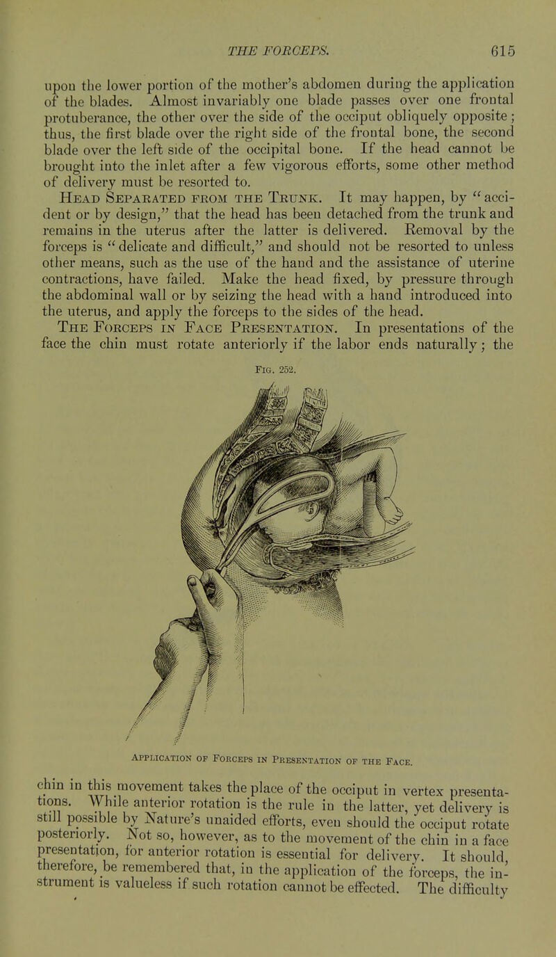 upon the lower portion of the mother's abdomen during the application of the blades. Almost invariably one blade passes over one frontal protuberance, the other over the side of the occiput obliquely opposite ; thus, the first blade over the right side of the frontal bone, the second blade over the left side of the occipital bone. If the head cannot be brought into the inlet after a few vigorous efforts, some other method of delivery must be resorted to. Head Separated from the Trunk. It may happen, by  acci- dent or by design, that the head has been detached from the trunk and remains in the uterus after the latter is delivered. Removal by the forceps is  delicate and difficult, and should not be resorted to unless other means, such as the use of the hand and the assistance of uterine contractions, have failed. Make the head fixed, by pressure through the abdominal wall or by seizing the head with a hand introduced into the uterus, and apply the forceps to the sides of the head. The Forceps in Face Presentation. In presentations of the face the chin must rotate anteriorly if the labor ends naturally; the Fig. 252. Application of Forceps in Presentation of the Face. chin in this movement takes the place of the occiput in vertex presenta- tions. While anterior rotation is the rule in the latter, yet delivery is still possible by Nature's unaided efforts, even should the occiput rotate posteriorly. Not so, however, as to the movement of the chin in a face presentation, for anterior rotation is essential for delivery. It should therefore, be remembered that, in the application of the forceps, the in- strument is valueless if such rotation cannot be effected. The difficulty