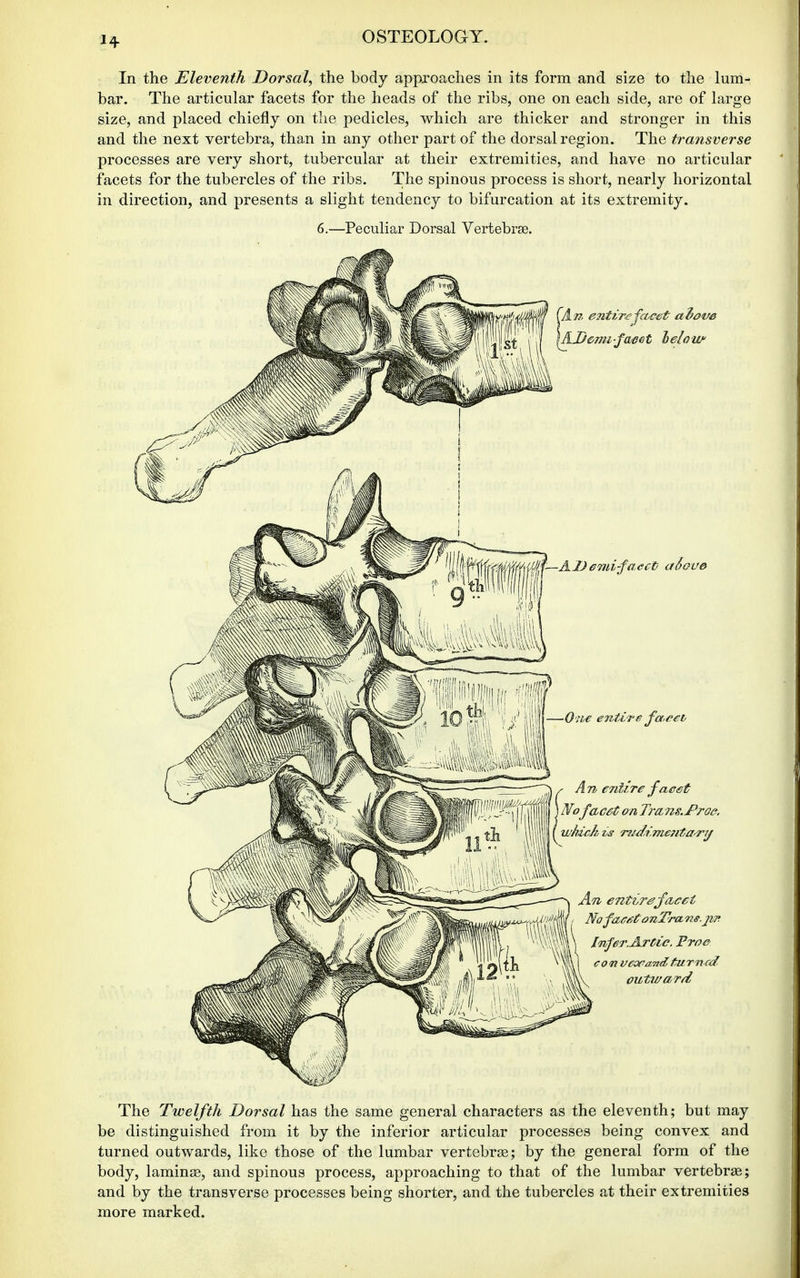 In the Eleventh Dorsal, the body approaches in its form and size to the lum- bar. The articular facets for the heads of the ribs, one on each side, are of large size, and placed chiefly on the pedicles, which are thicker and stronger in this and the next vertebra, than in any other part of the dorsal region. The transverse processes are very short, tubercular at their extremities, and have no articular facets for the tubercles of the ribs. The spinous process is short, nearly horizontal in direction, and presents a slight tendency to bifurcation at its extremity. 6.—Peculiar Dorsal Vertebrae. The Twelfth Dorsal has the same general characters as the eleventh; but may be distinguished from it by the inferior articular processes being convex and turned outwards, like those of the lumbar vertebrse; by the general form of the body, laminje, and spinous process, approaching to that of the lumbar vertebra; and by the transverse processes being shorter, and the tubercles at their extremities more marked.