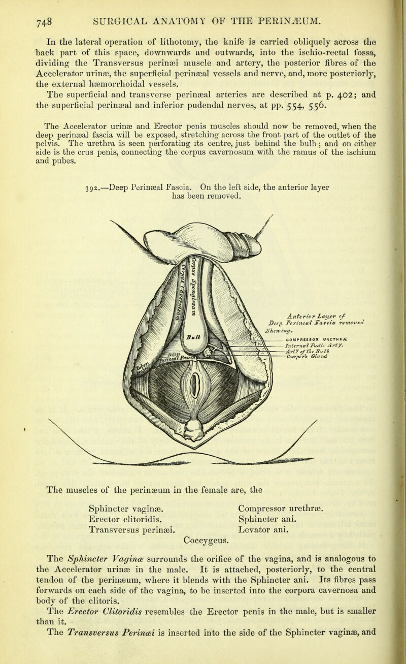 In the lateral operation of lithotomy, the knife is carried obliquely across the back part of this space, downwards and outwards, into the ischio-rectal fossa, dividing the Transversus perintBi muscle and artery, the posterior fibres of the Accelerator urinse, the superficial perinseal vessels and nerve, and, more posteriorly, the external heemorrhoidal vessels. The superficial and transverse perinseal arteries are described at p. 402; and the superficial perinasal and inferior pudendal nerves, at pp. 554, 556. The Accelerator urinse and Erector penis muscles should now be removed, when the deep perinssal fascia will be exposed, stretching across the front part of the outlet of the pelvis. The urethra is seen perforating its centre, just behind the bulb; and on either side is the crus penis, connecting the corpus cavernosum with the ramus of the ischium and pubes. 392.—Deep Perinseal Fascia. On the left side, the anterior layer has been removed. The muscles of the perinaeum in the female are, the Sphincter vaginae. Compressor urethrge. Erector clitoridis. Sphincter ani. Transversus perinasi. Levator ani. Coccygeus. The Sphincter VagincB surrounds the orifice of the vagina, and is analogous to the Accelerator urinae in the male. It is attached, posteriorly, to the central tendon of the perinaeum, where it blends with the Sphincter ani. Its fibres pass forwards on each side of the vagina, to be inserted into the corpora cavernosa and body of the clitoris. The Erector Clitoridis resembles the Erector penis in the male, but is smaller than it. The Transversus Perincei is inserted into the side of the Sphincter vaginae, and