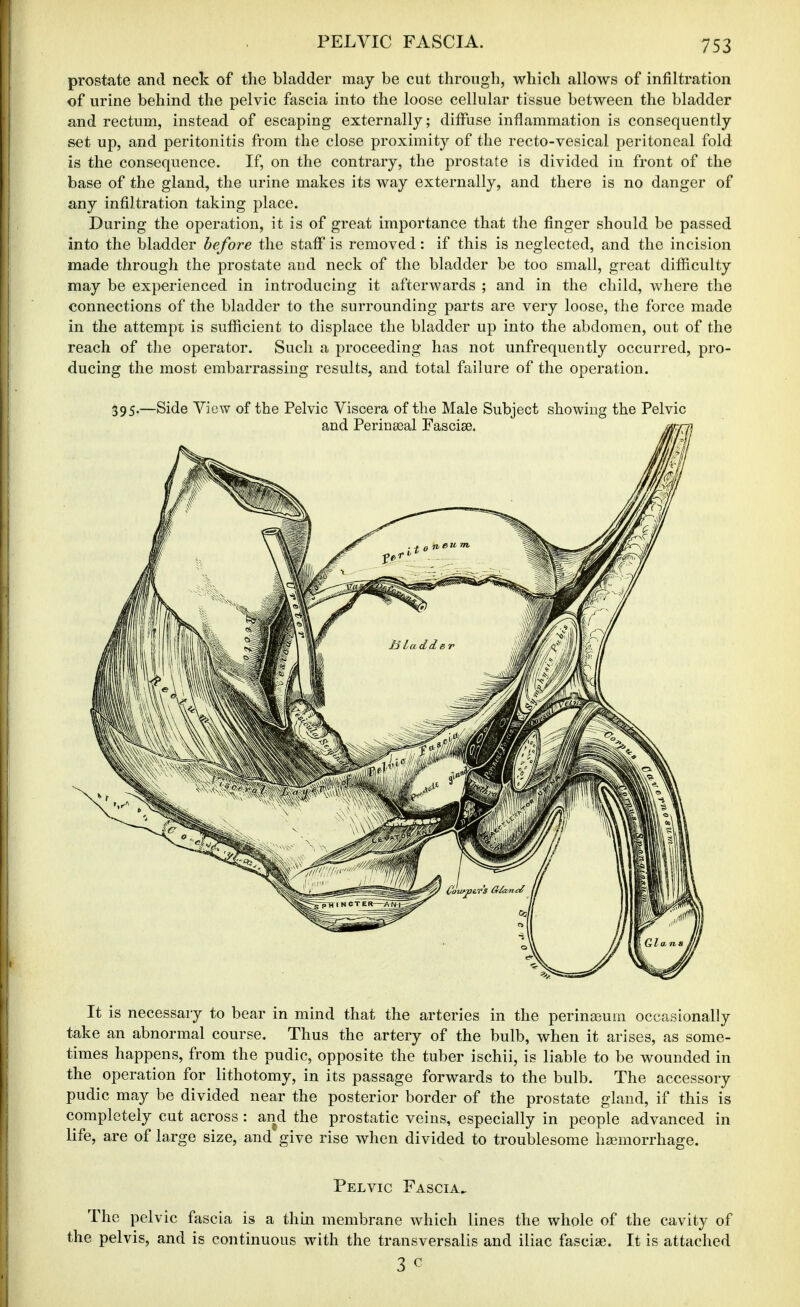 prostate and neck of the bladder may be cut through, which allows of infiltration of urine behind the pelvic fascia into the loose cellular tissue between the bladder and rectum, instead of escaping externally; diffuse inflammation is consequently set up, and peritonitis from the close proximity of the recto-vesical peritoneal fold is the consequence. If, on the contrary, the prostate is divided in front of the base of the gland, the urine makes its way externally, and there is no danger of any infiltration taking place. During the operation, it is of great importance that the finger should be passed into the bladder before the staff is removed: if this is neglected, and the incision made through the prostate and neck of the bladder be too small, great difficulty may be experienced in introducing it afterwards ; and in the child, where the connections of the bladder to the surrounding parts are very loose, the force made in the attempt is sufficient to displace the bladder up into the abdomen, out of the reach of the operator. Such a proceeding has not unfrequently occurred, pro- ducing the most embarrassing results, and total failure of the operation. 395.—Side View of the Pelvic Viscera of the Male Subject showing the Pelvic It is necessary to bear in mind that the arteries in the perinasum occasionally take an abnormal course. Thus the artery of the bulb, when it arises, as some- times happens, from the pudic, opposite the tuber ischii, is liable to be wounded in the operation for lithotomy, in its passage forwards to the bulb. The accessory pudic may be divided near the posterior border of the prostate gland, if this is completely cut across : and the prostatic veins, especially in people advanced in life, are of large size, and give rise when divided to troublesome haimorrhage. Pelvic Fascia. The pelvic fascia is a thin membrane which lines the whole of the cavity of the pelvis, and is continuous with the transversalis and iliac fasciag. It is attached 3 c