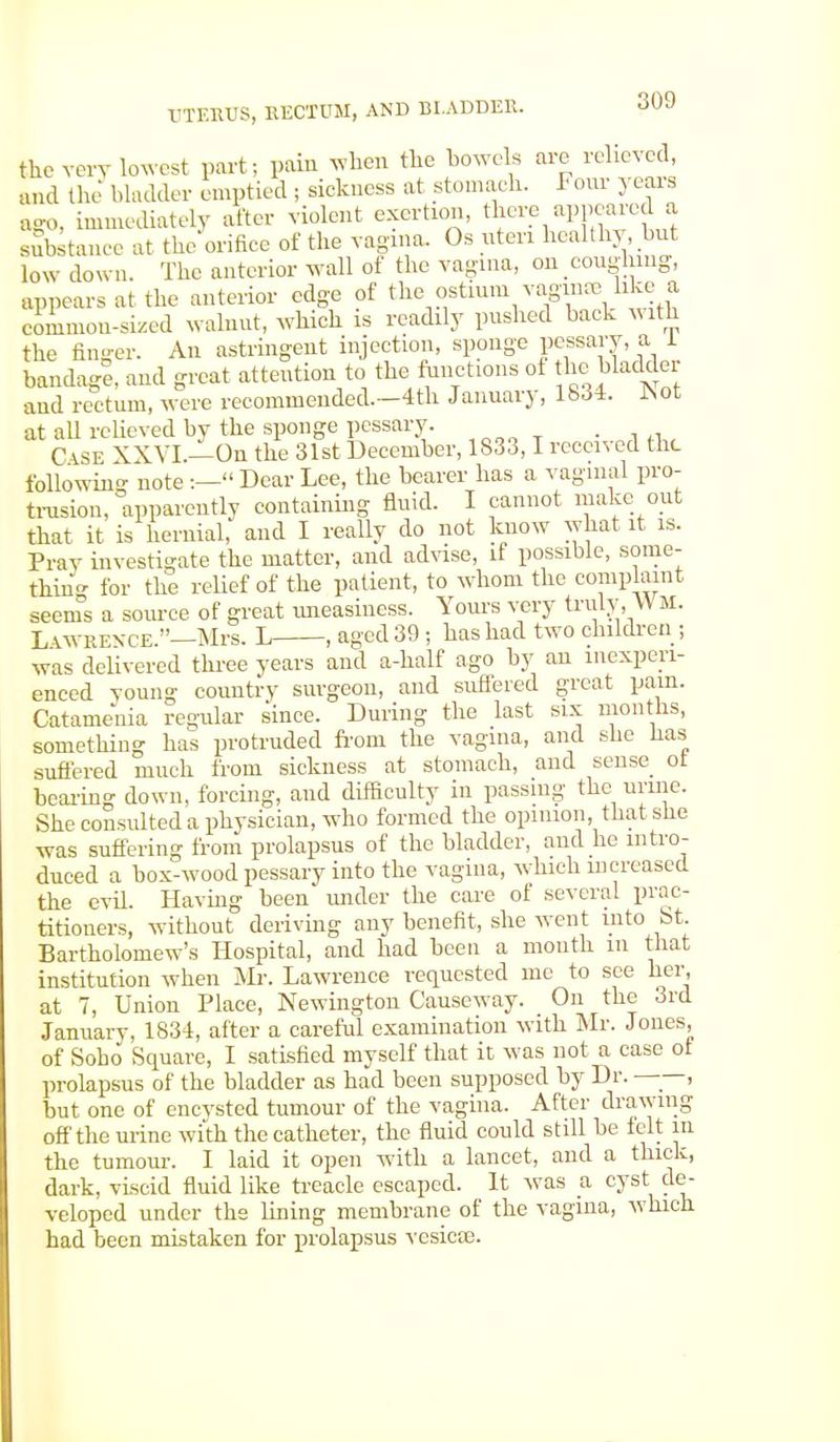 the very lowest part; pain when the bowels are relieved, and the bladder emptied ; sickness at stomach. Four- years ago, immediately after violent exertion, there appeared a substance at the orifice of the vagina. Os uteri healthy but low down. The anterior wall of the vagina, on coughing, appears at the anterior edge of the ostium vagina li ce a common-sized walnut, which is readily pushed back with the finger. An astringent injection, sponge pessary, a 1 bandag?, and great attention to the functions of *e bladder and rectum, were recommended.—4th January, 18,34. JNot at all relieved by the sponge pessary. CkSE XXVI.—On the 31st December, 1833,1 received the following note:— Dear Lee, the bearer has a vaginal pro- trusion, apparently containing fluid. I cannot make out that it is hernial, and I really do not know what it is. Pray investigate the matter, and advise, if possible, some- thin'- for the relief of the patient, to whom the complaint seems a source of great uneasiness. Yours very truly, WM. Lawrence.—Mrs. L , aged 39 ; has had two children ; was delivered three years and a-half ago by au inexperi- enced young country surgeon, and suffered great pain. Catamenia regular since. During the last six months, something has protruded from the vagina, and she has suffered much from sickness at stomach, and sense ot bearing down, forcing, and difficulty in passing the urnie. She consulted a physician, who formed the opinion that she was suffering from prolapsus of the bladder, and he intro- duced a box-wood pessary into the vagina, which increased the evil. Having been under the care of several prac- titioners, without deriving any benefit, she went into St. Bartholomew's Hospital, and had been a month in that institution when Mr. Lawrence requested me to see her, at 7, Union Place, Newington Causeway. On the 3rd January, 1834, after a careful examination with Mr. Jones, of Soho Square, I satisfied myself that it was not a case of prolapsus of the bladder as had been supposed by Dr. ——, but one of encysted tumour of the vagina. After drawing off the urine with the catheter, the fluid could still be felt m the tumour. I laid it open with a lancet, and a thick, dark, viscid fluid like treacle escaped. It was a cyst de- veloped under the lining membrane of the vagina, which had been mistaken for prolapsus vesicsc.