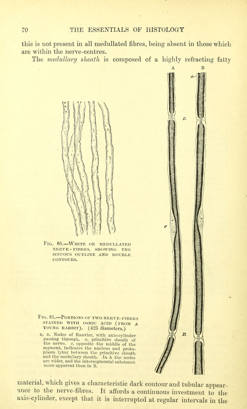 this is not present in all medullated fibres, being absent in those which are within the nerve-centres. The medullary sheath is composed of a highly refracting fatty Fig. 80.—White ok medullated nerve - fibres, showing the sinuous outline and double contours. Fig. 81.—Portions of two nerve- fibres STAINED with OSMIC ACID (frOM A YOUNG RABBIT). (425 diameters.) E, E. Nodes of Rauvier, with axis-cylinder passing thxough. a, primitive sheath of the nerve, c, opposite the middle of the segment, indicates the nucleus and proto- plasm lyin? between the primitive sheath and the medullary sheath. In A the nodes are wider, and the intersegmental substance more apparent than in B. material, which gives a characteristic dark contour and tubular appear- ance to the nerve-fibres. It afi'ords a continuous investment to the axis-cylinder, except that it is interrupted at regular intervals in the