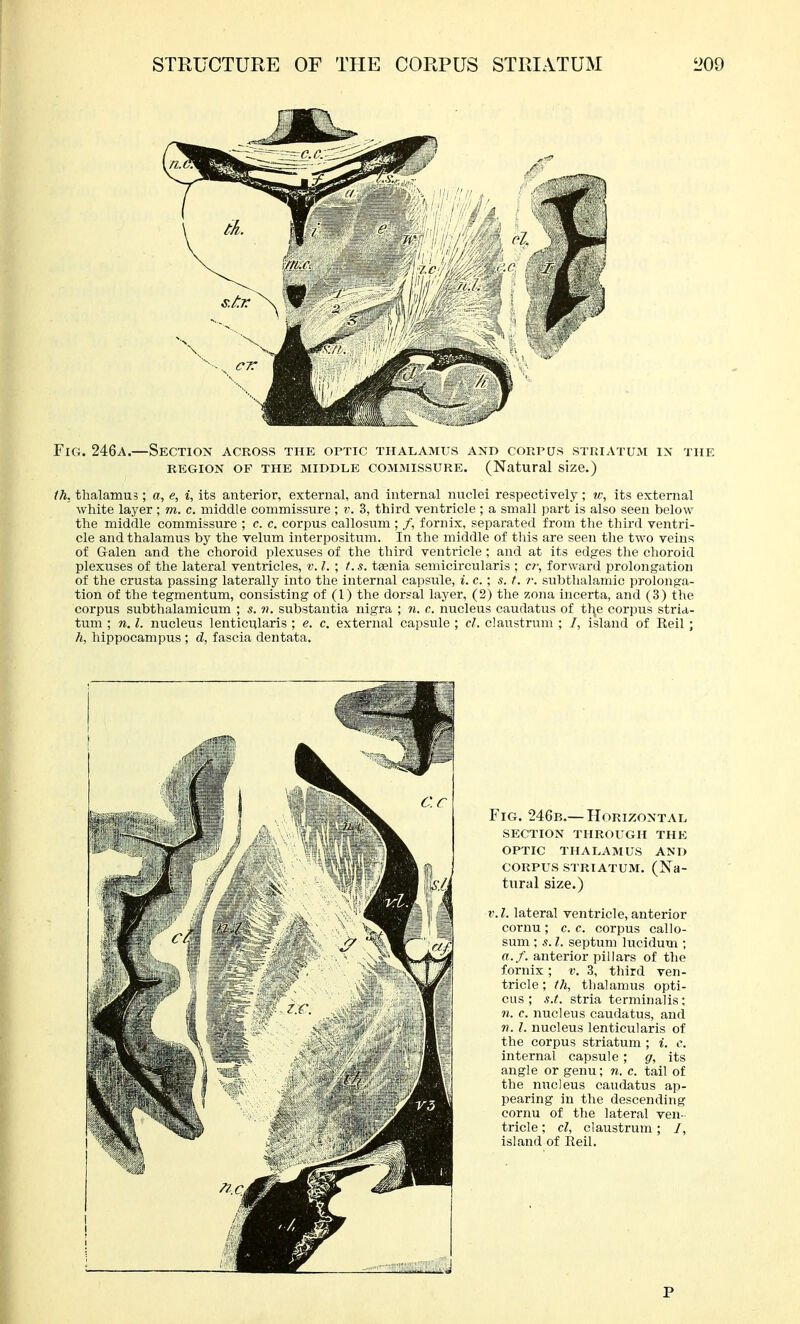 STRUCTURE OF THE CORPUS STRIATUM i>09 Fig. 246a.—Section across the optic thalamus and corpus striatum in the REGION OF the MIDDLE COMMISSURE. (Natural size.) (h. thalamus; a, e, i, its anterior, external, and internal nuclei respectively; w, its external white layer; m. c. middle commissure ; v. 3, third ventricle ; a small part is also seen below the middle commissure ; c. c. corpus callosum ; /, fornix, separated from the third ventri- cle and thalamus by the velum interpositum. In the middle of this are seen the two veins of Galen and the choroid plexuses of the third ventricle; and at its edges the choroid plexuses of the lateral ventricles, v. I. ; /. s. taenia semicircularis ; c?; forward prolongation of the crusta passing laterally into the internal capsule, i. c.; s. t. r. subthalamic prolonga- tion of the tegmentum, consisting of (1) the dorsal layer, (2) the zona incerta, and (3) the corpus subthalamicum ; s. «. substantia nigra ; n. c. nucleus caudatus of tl\e corpus stria- tum ; n. I. nucleus lenticularis ; e. c. external capsule ; cl. claustrum ; /, island of Reil; h, hippocampus ; d, fascia dentata. Fig. 246b.— Horizontal section through the optic thalamus and CORPUS STRIATUM. (Na- tural size.) V. I. lateral ventricle, anterior cornu; c. c. corpus callo- sum ; s. I. septum lucidum ; a./, anterior pillars of the fornix; v. 3, third ven- tricle ; th, thalamus opti- cus ; s.t. stria terminalis; n. c. nucleus caudatus, and 71. I. nucleus lenticularis of the corpus striatum ; i. c. internal capsule; g, its angle or genu; n. c. tail of the nucleus caudatus ap- pearing in the descending cornu of the lateral ven- tricle ; cl, claustrum; /, island of Reil.