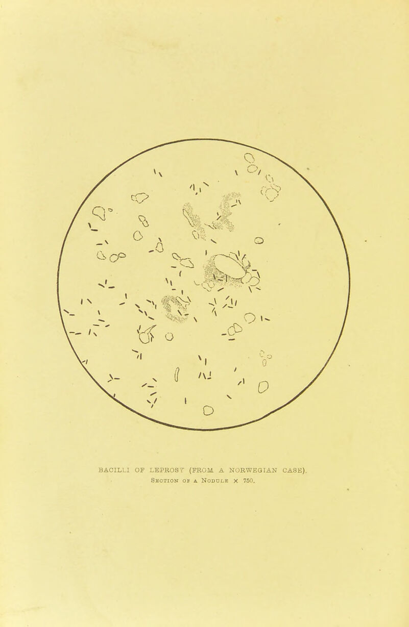 BACILLI OF LEPR0S7 (FROM A NORWEGIAN CASE), Section of a Noddle x 750.