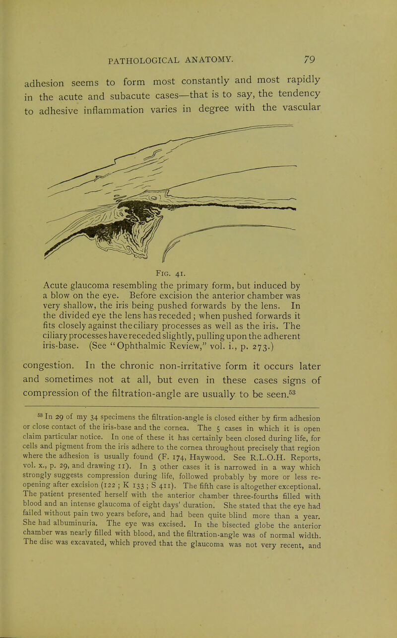 adhesion seems to form most constantly and most rapidly in the acute and subacute cases—that is to say, the tendency to adhesive inflammation varies in degree with the vascular Fig. 41. Acute glaucoma resembling the primary form, but induced by a blow on the eye. Before excision the anterior chamber was very shallow, the iris being pushed forwards by the lens. In the divided eye the lens has receded; when pushed forwards it fits closely against theciliary processes as well as the iris. The ciliary processes have receded slightly, pulling upon the adherent iris-base. (See Ophthalmic Review, vol. i., p. 273.) congestion. In the chronic non-irritative form it occurs later and sometimes not at all, but even in these cases signs of compression of the filtration-angle are usually to be seen.^^ 68 In 29 of my 34 specimens the filtration-angle is closed either by firm adhesion or close contact of the iris-base and the cornea. The 5 cases in which it is open claim particular notice. In one of these it has certainly been closed during life, for cells and pigment from the iris adhere to the cornea throughout precisely that region where the adhesion is usually found (F. 174, Haywood. See R.L.O.H. Reports, vol. X., p. 29, and drawing 11). In 3 other cases it is narrowed in a way which strongly suggests compression during life, followed probably by more or less re- opening after excision (122 ; K 133 ; S 411). The fifth case is altogether exceptional. The patient presented herself with the anterior chamber three-fourths filled with blood and an intense glaucoma of eight days' duration. She stated that the eye had failed without pain two years before, and had been quite blind more than a year. She had albuminuria. The eye was excised. In the bisected globe the anterior chamber was nearly filled with blood, and the filtration-angle was of normal width. The disc was excavated, which proved that the glaucoma was not very recent, and