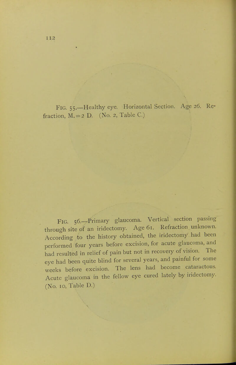 I 12 Fig. 55.—Healthy eye. Horizontal Section. Age 26. Re- fraction, M. = 2 D. (No. 2, Table C.) Fig. 56.—Primary glaucoma. Vertical section passing through site of an iridectomy. Age 61. Refraction unknown. According to the history obtained, the iridectomy had been performed four years before excision, for acute glaucoma, and had resulted in relief of pain but not in recovery of vision. The eye had been quite blind for several years, and painful for some weeks before excision. The lens had become cataractous. Acute glaucoma in the fellow eye cured lately by iridectomy. (No. 10, Table D.)