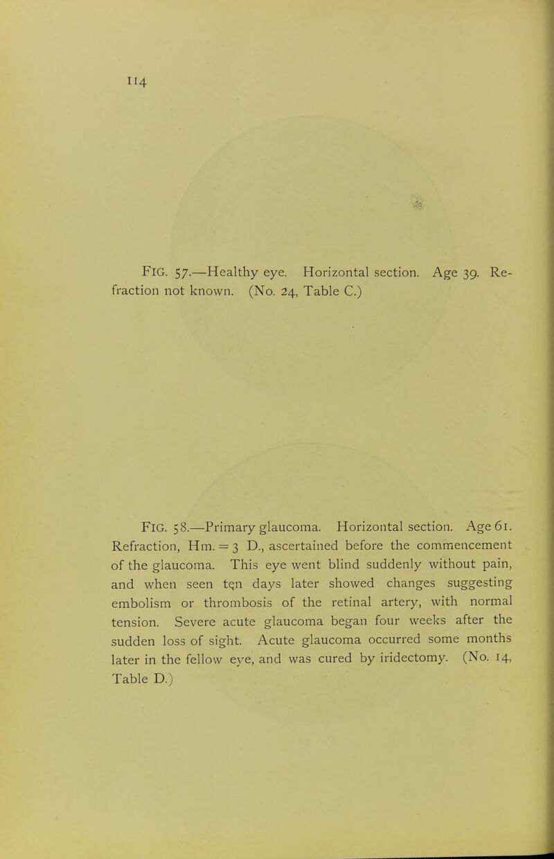 Fig. 57.—Healthy eye. Horizontal section. Age 39. Re- fraction not known. (No. 24, Table C.) Fig. 58.—Primary glaucoma. Horizontal section. Age 61. Refraction, Hm. = 3 D., ascertained before the commencement of the glaucoma. This eye went blind suddenly without pain, and when seen t^n days later showed changes suggesting embolism or thrombosis of the retinal artery, with normal tension. Severe acute glaucoma began four weeks after the sudden loss of sight. Acute glaucoma occurred some months later in the fellow eye, and was cured by iridectomy. (No. 14, Table D.)