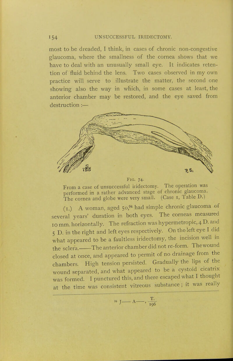 most to be dreaded, I think, in cases of chronic non-congestive glaucoma, where the smallness of the cornea shows that we have to deal with an unusually small eye. It indicates reten- tion of fluid behind the lens. Two cases observed in my own practice will serve to illustrate the matter, the second one showing also the way in which, in some cases at least, the anterior chamber may be restored, and the eye saved from destruction :— Fig. 74. From a case of unsuccessful iridectomy. The operation was performed in a rather advanced stage of chronic^ glaucoma. The cornea and globe were very small. (Case i, Table D.) (i.) A woman, aged 50,8* had simple chronic glaucoma of several years' duration in both eyes. The corneas measured 10 mm. horizontally. The refraction was hypermetropic, 4 D. and 5 D. in the right and left eyes respectively. On theTeft eye I did what appeared to be a faultless iridectomy, the incision well in the sclera. The anterior chamber did not re-form. The wound closed at once, and appeared to permit of no drainage from the chambers. High tension persisted. Gradually the lips of the wound separated, and what appeared to be a cystoid cicatrix was formed. I punctured this, and there escaped what I thought at the time was consistent vitreous substance ; it was really