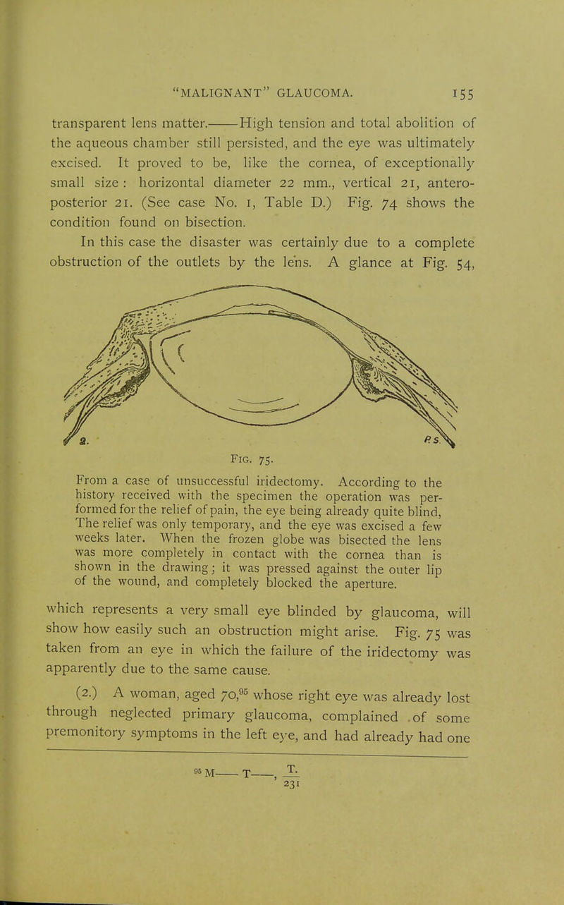 transparent lens matter. High tension and total abolition of the aqueous chamber still persisted, and the eye was ultimately excised. It proved to be, like the cornea, of exceptionally small size : horizontal diameter 22 mm., vertical 21, antero- posterior 21. (See case No. i, Table D.) Fig. 74 shows the condition found on bisection. In this case the disaster was certainly due to a complete obstruction of the outlets by the lens. A glance at Fig. 54, Fig. 75. From a case of unsuccessful iridectomy. According to the history received with the specimen the operation was per- formed for the relief of pain, the eye being already quite bhnd. The relief was only temporary, and the eye was excised a few weeks later. When the frozen globe was bisected the lens was more completely in contact with the cornea than is shown in the drawing; it was pressed against the outer lip of the wound, and completely blocked the aperture. which represents a very small eye blinded by glaucoma, will show how easily such an obstruction might arise. Fig. 75 was taken from an eye in which the failure of the iridectomy was apparently due to the same cause. (2.) A woman, aged 70,05 whose right eye was already lost through neglected primary glaucoma, complained .of some premonitory symptoms in the left e3'e, and had already had one 95 M T , _L 231