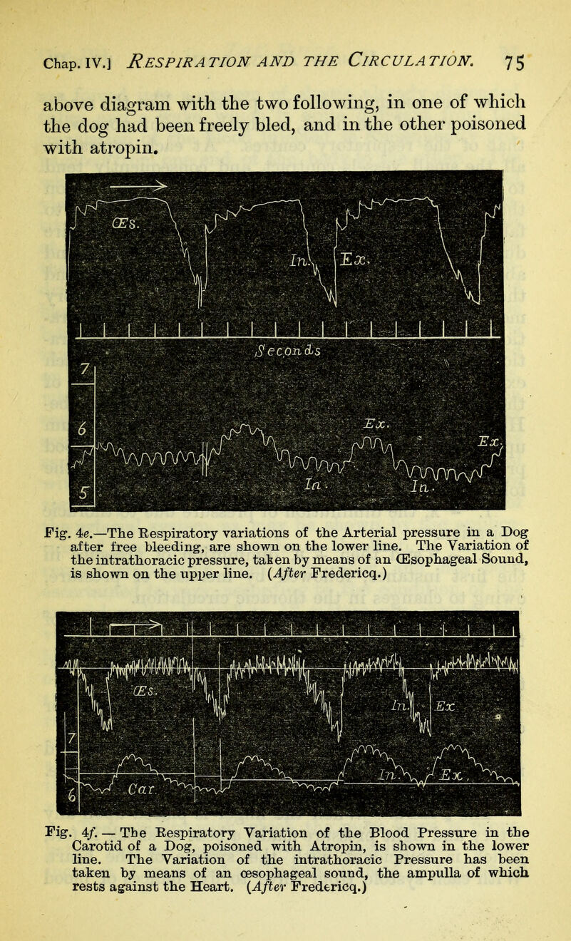 above diagram with the two following, in one of which the dog had been freely bled, and in the other poisoned with atropin. Fi^. 40.—The Eespiratory variations of the Arterial pressure in a Dog after free bleeding, are shown on the lower line. The Variation of the intrathoracic pressure, taken by means of an (Esophageal Sound, is shown on the upper line. {After Fredericq.) Fig. 4/. — The Eespiratory Variation of the Blood Pressure in the Carotid of a Dog, poisoned with Atropin, is shown in the lower line. The Variation of the intrathoracic Pressure has been taken by means of an oesophageal sound, the ampulla of which rests against the Heart. {After Fredericq.)