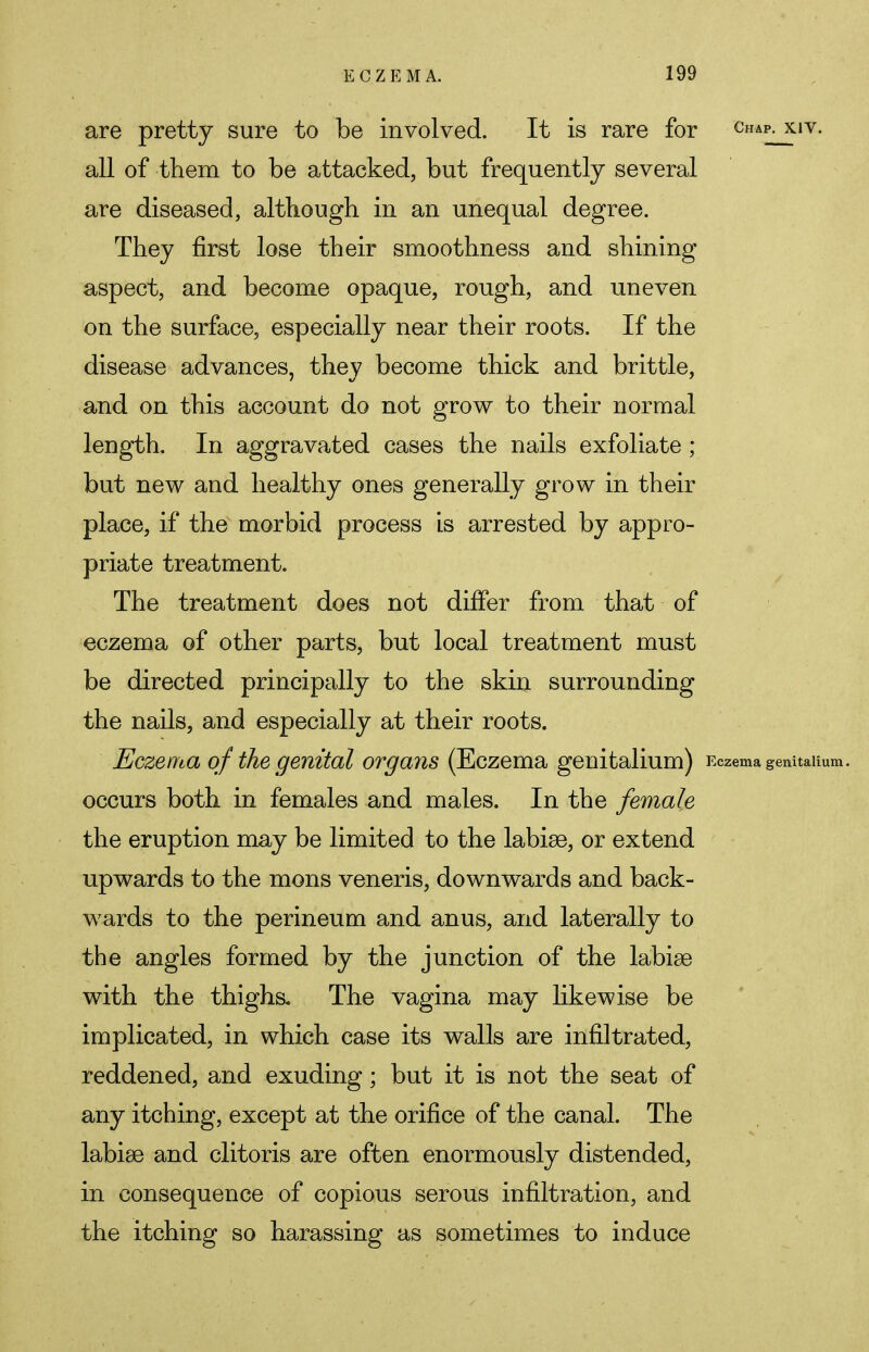 are pretty sure to be involved. It is rare for Chap- X1V- all of them to be attacked, but frequently several are diseased, although in an unequal degree. They first lose their smoothness and shining aspect, and become opaque, rough, and uneven on the surface, especially near their roots. If the disease advances, they become thick and brittle, and on this account do not grow to their normal length. In aggravated cases the nails exfoliate ; but new and healthy ones generally grow in their place, if the morbid process is arrested by appro- priate treatment. The treatment does not differ from that of eczema of other parts, but local treatment must be directed principally to the skin surrounding the nails, and especially at their roots. Eczema of the genital organs (Eczema genitalium) Eczema genitaiium. occurs both in females and males. In the female the eruption may be limited to the labise, or extend upwards to the mons veneris, downwards and back- wards to the perineum and anus, and laterally to the angles formed by the junction of the labise with the thighs. The vagina may likewise be implicated, in which case its walls are infiltrated, reddened, and exuding; but it is not the seat of any itching, except at the orifice of the canal. The labise and clitoris are often enormously distended, in consequence of copious serous infiltration, and the itching so harassing as sometimes to induce