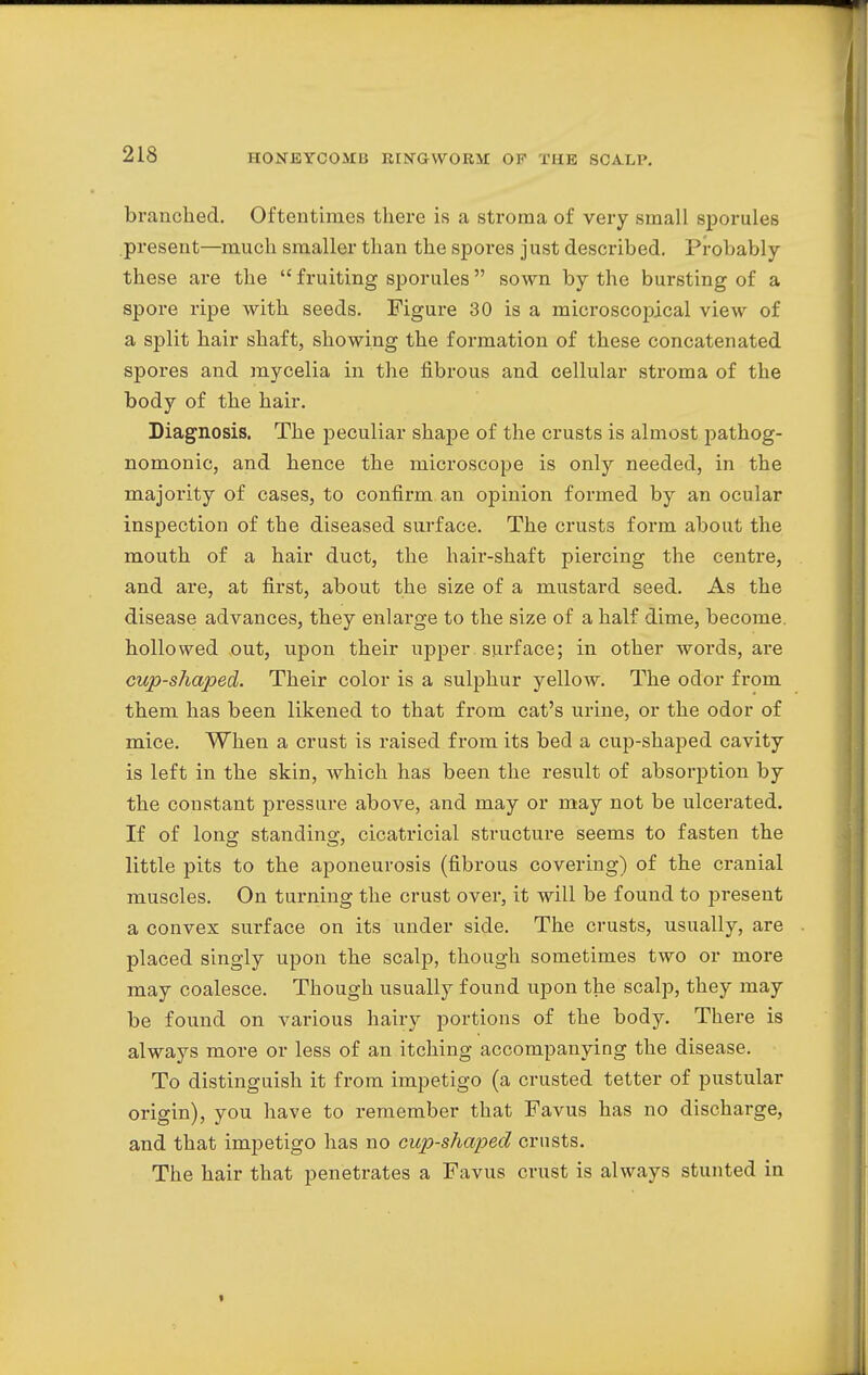 branched. Oftentimes there is a stroma of very small sporules present—much smaller than the spores just described. Probably these are the  fruiting sporules  sown by the bursting of a spore ripe with seeds. Figure 30 is a microscopical view of a split hair shaft, showing the formation of these concatenated spores and mycelia in the fibrous and cellular stroma of the body of the hair. Diagnosis. The peculiar shape of the crusts is almost pathog- nomonic, and hence the microscope is only needed, in the majority of cases, to confirm an opinion formed by an ocular inspection of the diseased surface. The crusts form about the mouth of a hair duct, the hair-shaft piercing the centre, and are, at first, about the size of a mustard seed. As the disease advances, they enlarge to the size of a half dime, become, hollowed out, upon their upper, surface; in other words, are cup-shaped. Their color is a sulphur yellow. The odor from them has been likened to that from cat's urine, or the odor of mice. When a crust is raised from its bed a cup-shaped cavity is left in the skin, which has been the result of absorption by the constant pressure above, and may or may not be ulcerated. If of long standing, cicatricial structure seems to fasten the little pits to the aponeurosis (fibrous covering) of the cranial muscles. On turning the crust over, it will be found to present a convex surface on its under side. The crusts, usually, are placed singly upon the scalp, though sometimes two or more may coalesce. Though usually found upon the scalp, they may be found on various hairy portions of the body. There is always more or less of an itching accompanying the disease. To distinguish it from impetigo (a crusted tetter of pustular origin), you have to remember that Favus has no discharge, and that impetigo has no cup-shaped crusts. The hair that penetrates a Favus crust is always stunted in