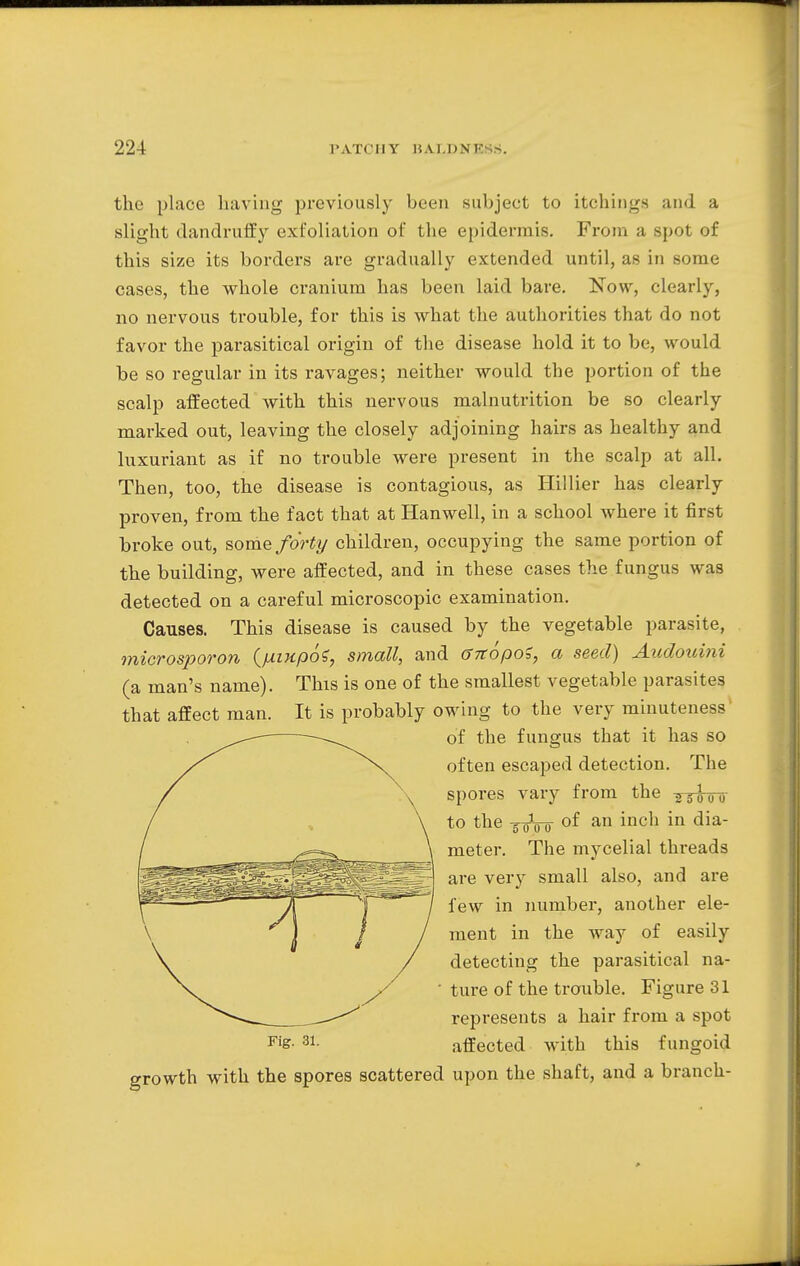the place having previously been subject to itchings and a slight dandruffy exfoliation of the epidermis. From a spot of this size its borders are gradually extended until, as in some cases, the whole cranium has been laid bare. Now, clearly, no nervous trouble, for this is what the authorities that do not favor the parasitical origin of the disease hold it to be, would be so regular in its ravages; neither would the portion of the scalp affected with this nervous malnutrition be so clearly marked out, leaving the closely adjoining hairs as healthy and luxuriant as if no trouble were present in the scalp at all. Then, too, the disease is contagious, as Hillier has clearly proven, from the fact that at Hanwell, in a school where it first broke out, some forty children, occupying the same portion of the building, were affected, and in these cases the fungus was detected on a careful microscopic examination. Causes. This disease is caused by the vegetable parasite, microsporon (jAiupoS, small, and GnopoS, a seed) Audouini (a man's name). This is one of the smallest vegetable parasites It is probably owing to the very minuteness1 of the fungus that it has so often escaped detection. The spores vary from the 25l0{) to the -g-oVo of an inch in dia- meter. The mycelial threads are very small also, and are few in number, another ele- ment in the way of easily detecting the parasitical na- ture of the trouble. Figure 31 represents a hair from a spot FiS' 81- affected with this fungoid growth with the spores scattered upon the shaft, and a branch- that affect man.