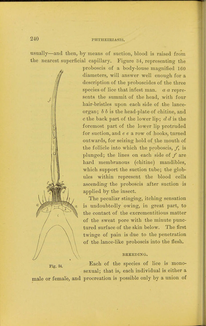 PHTHEIEIASl . J usually—and then, by means of suction, blood is raised from the nearest superficial capillary.. Figure 34, representing the proboscis of a body-louse magnified 160 diameters, will answer well enough for a description of the proboscides of the three species of lice that infest man. a a repre- sents the summit of the head, with four hair-bristles upon each side of the lance- organ ; b b is the head-plate of chitine, and c the back part of the lower lip; d d is the foremost part of the lower lip protruded for suction, and e e a row of hooks, turned outwards, for seizing hold of the mouth of the follicle into which the proboscis, f, is plunged; the lines on each side of f are hard membranous (chitine) mandibles, which support the suction tube; the glob- ules within represent the blood cells ascending the proboscis after suction is applied by the insect. The peculiar stinging, itching sensation is undoubtedly owing, in great part, to the contact of the excrementitious matter of the sweat pore with the minute punc- tured surface of the skin below. The first twinge of pain is due to the penetration of the lance-like proboscis into the flesh. BREEDING. Each of the species of lice is mono- sexual; that is, each individual is either a male or female, and procreation is possible only by a union of Fig. 34.