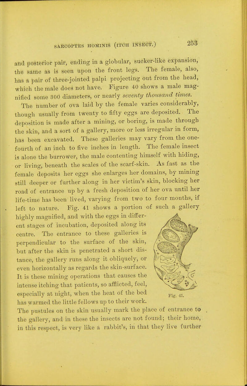 and posterior pair, ending in a globular, sucker-like expansion, the same as is seen upon the front legs. The female, also, has a pair of three-jointed palpi projecting out from the head, which the male does not have. Figure 40 shows a male mag- nified some 300 diameters, or nearly seventy thousand times. The number of ova laid by the female varies considerably, though usually from twenty to fifty eggs are deposited. The deposition is made after a mining, or boring, is made through the skin, and a sort of a gallery, more or less irregular in form, has been excavated. These galleries may vary from the one- fourth of an inch to five inches in length. The female insect is alone the burrower, the male contenting himself with hiding, or livinor, beneath the scales of the scarf-skin. As fast as the female deposits her eggs she enlarges her domains, by mining still deeper or further along in her victim's skin, blocking her road of entrance up by a fresh deposition of her ova until her life-time has been lived, varying from two to four months, if left to nature. Fig. 41 shows a portion of such a gallery highly magnified, and with the eggs in differ- ent stages of incubation, deposited along its centre. The entrance to these galleries is perpendicular to the surface of the skin, but after the skin is penetrated a short dis- tance, the gallery runs along it obliquely, or even horizontally as regards the skin-surface. It is these mining operations that causes the intense itching that patients, so afflicted, feel, especially at night, when the heat of the bed has warmed the little fellows up to their work. The pustules on the skin usually mark the place of entrance to the gallery, and in these the insects are not found; their home, in this respect, is very like a rabbit's, in that they live further