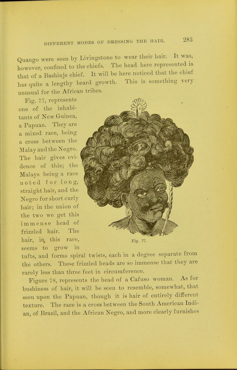 Quango were seen by Livingstone to wear their hair. It was, however, confined to the chiefs. The head here represented is that of a Bashinje chief. It will be here noticed that the chief has quite a lengthy beard growth. This is something very unusual for the African tribes. Fig. 11, represents one of the inhabi- tants of New Guinea, a Papuan. They are a mixed race, being a cross between the Malay andthe Negro. The hair gives evi- dence of this; the Malays being a race noted for long, straight hair, and the Negro for short curly hair; in the union of the two we get this immense head of frizzled hair. The hair, hi, this race, seems to grow in tufts, and forms spiral twists, each in a degree separate from the others. These frizzled heads are so immense that they are rarely less than three feet in circumference. Figure 78, represents the head of a Cafuso woman. As for bushiness of hair, it will be seen to resemble, somewhat, that seen upon the Papuan, though it is hair of entirely different texture. The race is a cross between the South American Indi- an, of Brazil, and the African Negro, and more clearly furnishes