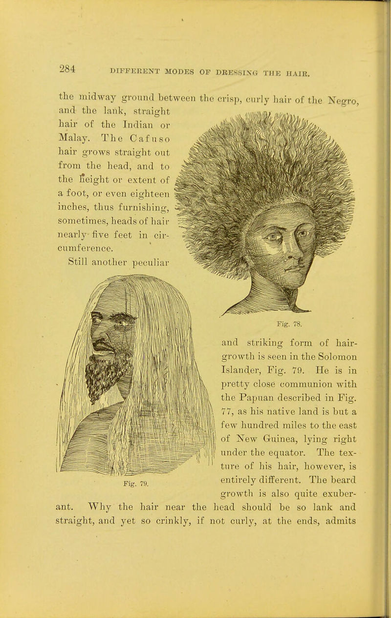the midway ground between the crisp, curly hair of the Negro, and the lank, straight hair of the Indian or Malay. The Cafuso hair grows straight out from the head, and to the l'eight or extent of a foot, or even eighteen inches, thus furnishing, sometimes, heads of hair nearly five feet in cir- cumference. Still another peculiar Fig. 78. and striking form of hair- growth is seen in the Solomon Islander, Fig. 79. He is in pretty close communion with the Papuan described in Fig. 77, as his native land is but a few hundred miles to the east of New Guinea, lying right under the equator. The tex- ture of his hair, however, is entirely different. The beard growth is also quite exuber- ant. Why the hair near the head should be so lank and straight, and yet so crinkly, if not curly, at the ends, admits