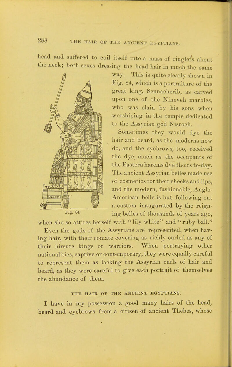 THE HAIR OF THE ANCIENT EGYPTIANS. head and suffered to coil itself into a mass of ringlets about the neck; both sexes dressing the head hair in much the same way. This is quite clearly shown in Fig. 84, which is a portraiture of the great king, Sennacherib, as carved upon one of the Nineveh marbles, who was slain by his sons when worshiping in the temple dedicated to the Assyrian god Nisroch. Sometimes they would dye the hair and beard, as the moderns now do, and the eyebrows, too, received the dye, much as the occupants of the Eastern harems dye theirs to-day. The ancient Assyrian belles made use of cosmetics for their cheeks and lips, and the modern, fashionable, Anglo- American belle is but following out a custom inaugurated by the reign- ing belles of thousands of years ago, when she so attires herself with lily white and ruby ball. Even the gods of the Assyrians are represented, when hav- ing hair, with their comate covering as richly curled as any of their hirsute kings or warriors. When portraying other nationalities, captive or contemporary, they were equally careful to represent them as lacking the Assyrian curls of hair and beard, as they were careful to give each portrait of themselves the abundance of them. Fig. 84. THE HAIR OF THE ANCIENT EGYPTIANS. I have in my possession a good many hairs of the head, beard and eyebrows from a citizen of ancient Thebes, whose