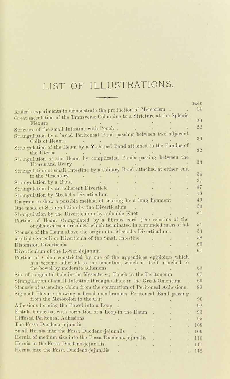 LIST OF ILLUSTRATIONS. Kader's experiments to demonstrate the production of Meteorism Great sacculation of the Transverse Colon due to a Stricture at the Splenic FJexure . . . ■ • Stricture of the small Intestine with Pouch . Strangulation by a broad Peritoneal Band passing between two adjacent Coils of Ileum Stranoiilation of the Ileum by a Y-shaped Band attached to the Fundus of the Uterus Strangulation of the Ileum by complicated Bands passing hetween the Uterus and Ovary . . . • Strangulation of small Intestine by a solitary Band attached at either end to the Mesentery Strangulation by a Band Strangulation hy an adherent Diverticle .... Strangulation by Meckel's Diverticulum .... Diagram to show a possible method of snaring by a long ligament One mode of Strangulation by the Diverticulum ... Strangulation by the Diverticulum by a double Knot Portion of Ileum strangulated by a fibrous cord (the remains of the omphalo-mesenteric duct) which terminated in a rounded mass of fat Stenosis of the Ileum above the origin of a Meckel's Diverticulum . i\lultiple Sacculi or Diverticula of the Small Intestine Distension Diverticula ....... Diverticulum of the Lower Jejunum . . . . . Portion of Colon constricted by one of the appendices epiploicte which has become adherent to the omentum, which is itself attached to the bowel by moderate adhesions .... Site of congenital hole in the Mesentery ; Pouch in the Peritoneum Strangulation of small Intestine through a hole in the Great Omentum Stenosis of ascending Colon from the contraction of Peritoneal Adhesions Sigmoid Flexure showing a broad membranous Peritoneal Band passing from the Mesocolon to the Gut Adhesions forming the Bowel into a Loop . Fistula bimucosa, with formation of a Loop in the Ileum Diifused Peritoneal Adhesions The Fcssa Duodeno-jejunalis . . Small Hernia into the Fossa Duodeno-jejunalis Hernia of medium size into the Fossa Duodeno-jejunalis Hernia in the Fossa Duodeno-jejunalis Hernia into the Fossa Duodeno-jejunalis PAGE 14 20 22 30 32 33 34 37 47 48 49 50 .51 .51 53 58 60 61 Go 67 69 89 90 92 93 95 108 109 110 111 112