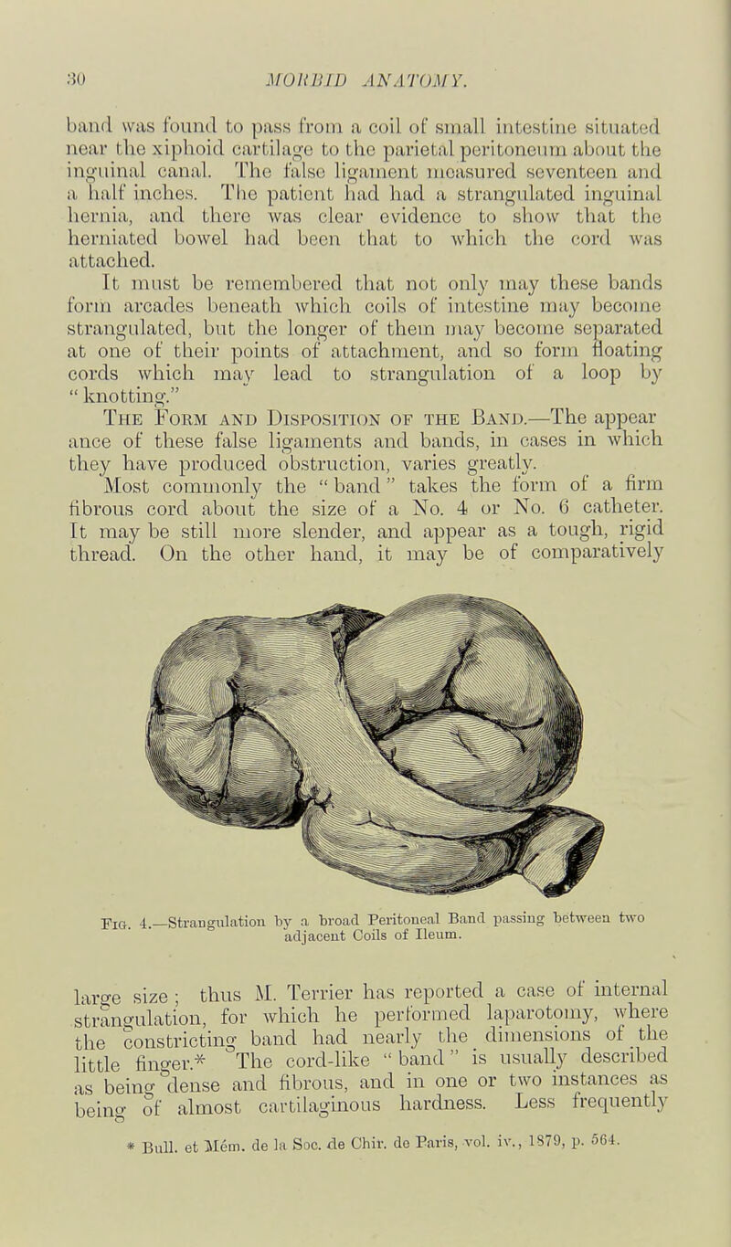 band was found to pass from a coil of small intestine situated near the xiphoid cartilage to the parietal peritoneum about the inguinal canal. The false ligament measured seventeen and a half inches. Tlie patient had had a strangulated inguinal hernia, and there was clear evidence to show that the herniated bowel had been that to which the cord was attached. It must be remembered that not only may these bands form arcades beneath which coils of intestine may become strangulated, but the longer of them may become separated at one of their points of attachment, and so form floating cords which may lead to strangulation of a loop by  knottmg. The Form and Disposition of the Band.—The appear ance of these false ligaments and bands, m cases in Avhich they have produced obstruction, varies greatly. Most commonly the  band takes the form of a firm fibrous cord about the size of a No. 4 or No. 6 catheter. It may be still more slender, and appear as a tough, rigid thread. On the other hand, it may be of comparatively Fig 4.—Sti-cangulation by a broad Peritoneal Band passing between two adjacent Coils of Ileum. large size ; thus M. Terrier has reported a case of internal strangulation, for Avhich he performed laparotomy, where the constricting band had nearly the dimensions of the little fino-er.* The cord-like  band  is usually described as beinc^^dense and fibrous, and in one or two instances as being of almost cartilaginous hardness. Less frequently * Bull, et Mem. de la Soc. de Chir. de Paris, vol. iv., 1879, p. 564.