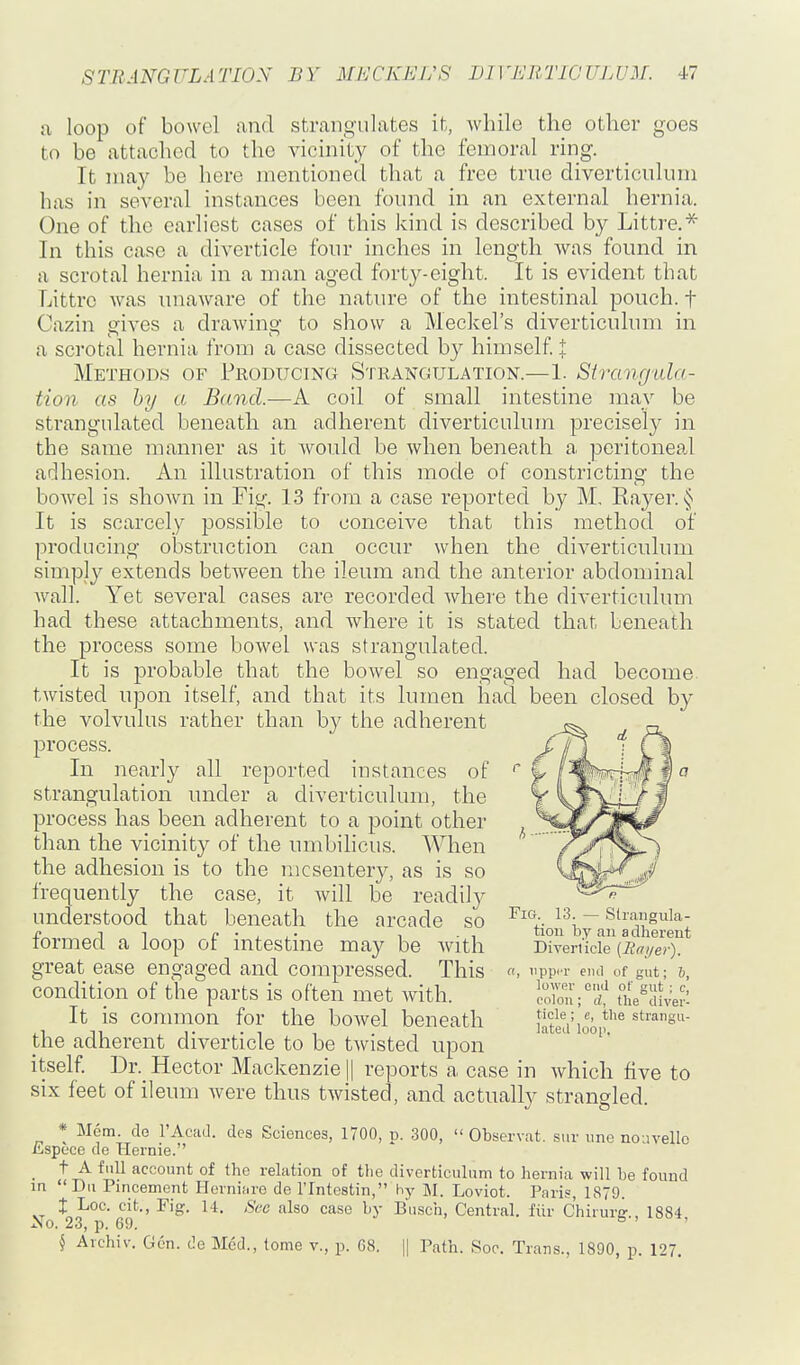 a loop of bowel and strangulates it, while the other goes to be attached to the vicinity of the femoral ring. It may be here mentioned that a free true diverticulum has in several instances been found in an external hernia. One of the earliest cases of this kind is described by Littre.* In this case a diverticle four inches in length was found in a scrotal hernia in a man aged fortj^-eight. It is evident that Littre was unaware of the nature of the intestinal pouch, f Cazin gives a drawing to show a Meclcel's diverticulum in a scrotal hernia from a case dissected by himself I Methods of Producing Strangulation.—1. Strangula- tion as by a Band.—A coil of small intestine may be strangulated beneath an adherent diverticulum precisely in the same manner as it would be when beneath a peritoneal adhesion. An illustration of this mode of constricting the bowel is shown in Fig. 13 from a case reported by M, Rayer. It is scarcely possible to conceive that this method of producing obstruction can occur when the diverticulum simply extends between the ileum and the anterior abdominal wall. Yet several cases are recorded where the diverticulum had these attachments, and where it is stated that beneath the process some bowel was strangulated. It is probable that the bowel so engaged had become twisted upon itself, and that its lumen hacl been closed by the volvulus rather than by the adherent „ process. J^iJ. Ll In nearly all reported instances of w iW'f^hm J strangulation under a diverticulum, the y i^v'/ '/J process has been adherent to a point other ^^m^^^ than the vicinity of the umbilicus. When ^1%^ the adhesion is to the mesentery, as is so frequently the case, it will be readilj^ O^V^ understood that beneath the arcade so -^v. 13-- Siranguia- p 11 r • J , • 1 -1 tioii by an adherent termed a loop ot mtestme may be with Diven'icie (Rai/er). great ease engaged and compressed. This ff, iippi-r eiul of gut; 6, condition of the parts is often met with. coionV? tue^cuver: It is common for the bowel beneath intld'ioo^^ the adherent_ diverticle to be tAvisted upon  itself. Dr. Hector Mackenzie j| reports a case in which five to six feet of ileum were thus twisted, and actually strangled. * Mem. do I'Acad. des Sciences, 1700, p. 300,  Observat. siir ime noavello £spece de Hernie. _ t A full account of the relation of the diverticulum to hernia will be found in Dii Pincement Hernii.re de I'lntestin, hy M. Loviot. Paris, 1879. X Loc. cit., Fif?. 14. Sec also case by Biisch, Central, fiir c'hiruro-., 1884 No. 23, p. 69. SI! § Avchiv. Gen. de Med., tome v., p. G8. || Path. Soc. Trans., 1890, p. 127,