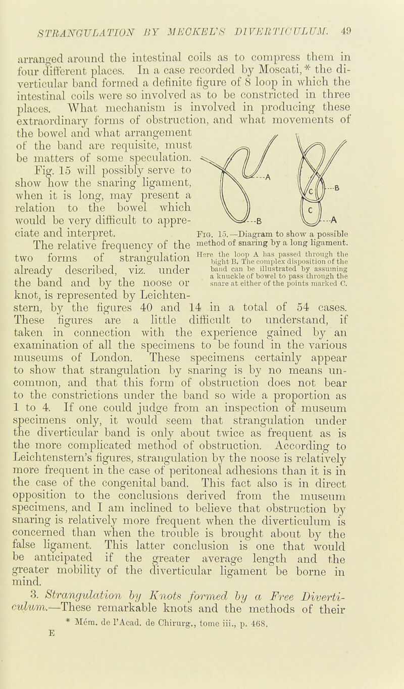 arranged around the intestinal coils as to compress them in four ditt'orent places. In a case recorded by Moscati, * the di- verticular band formed a definite figure of S loop in which the intestinal coils were so involved as to be constricted in three places. What mechanism is involved in producing these extraordinary forms of obstruction, and what movements of the bowel and Avhat arrangement of the band are requisite, must be matters of some speculation. Fig. 15 will possibly serve to show how the snaring ligament, when it is long, may present a relation to the bowel which would be very difficult to appre- ^^--b ciate and interpret. Fig. 15.—Diagi-am to show a possible The relative frequency of the method of snaring by a long ligament. tTO-n fnvTYic: nf otronrrnlitimT ^^'p- ''^P ^ passed tlnough the LWO lOimb Oi bUlcUlgUiaLlUU bight B. The complex disposition of the already described, viz. under baiul can be inustrated by a.ssuming , , , 111 a knuckle of bowel to pass chrongh tlie the band and by the noose or snare at either of the points marked C. knot, is represented by Leichten- stern, by the figures 40 and 14 in a total of 54 cases. These figures are a little difficult to understand, if taken in connection with the experience gained by an examination of all the specimens to be found in the various museums of London. These specimens certainl}'' appear to show that strangulation by snaring is by no means un- common, and that this form of obstruction does not bear to the constrictions under the band so wide a proportion as 1 to 4. If one could judge from an inspection of museum specimens only, it would seem that strangulation under the diverticular band is only about twice as frequent as is the more complicated method of obstruction. According to Leichtenstern's figures, strangulation by the noose is relatively more frequent in the case of peritoneal adhesions than it is in the case of the congenital band. This fact also is in direct opposition to the conclusions derived from the museum specimens, and I am inclined to believe that obstruction by snaring is relatively more frequent when the diverticulum is concerned than when the trouble is brought about by the false ligament. This latter conclusion is one that Avould be anticipated if the greater average length and the greater mobility of the diverticular ligament be borne in mind. 3. Strangulation by Knots formed by a Free Diverti- culum.—These remarkable knots and the methods of their * Mem. de I'Acad. de Chirurg'., tome iii., p. 468. E