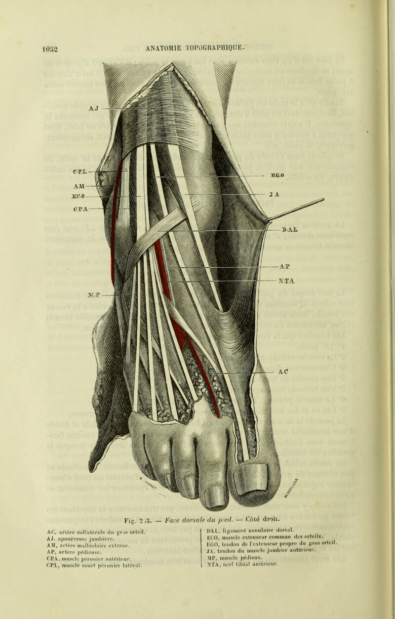 Fis. 2 j3. — Face dorsale du pied. — Coté droit. AC, ai'lci'C colltiléi'ale du gros orteil. AJ. aponévrose jainbicr(î. A M, artère malléolaire externe. AP, artère pértieuse. (.PA, muscle péronier antérieur. r.PL, muscle court péronier latéral. DAL, ligament annulaire dorsal. ECO, muscle extenseur commun des orteils. KGO, tendon de l'extenseur propre du gros orteil. .lA. tendon du nuisolc jambier antérieui-. .MP, muscle péilicux. NIA. nerl tiliial antérieur.