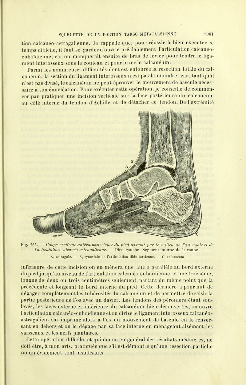 SQUELETTli blî LA l'OllTlON TARSO-MÉTATAlîSIliNNE. lOlil lion calcanéo-astragalienne. Je rappelle que, pour réussir à bien exécuter ce temps difficile, il faut se garder d'ouvrir préalablement l'articulation calcanéo- cuboïdienne, car on manquerait ensuite de bras de levier pour tendre le liga- ment interosseux sous le couteau et pour luxer le calcancum. Parmi les nombreuses difficultés dont est entourée la résection totale ducal- canéum, la section du ligament interosseux n'est pas la moindre, car, tant qu'il n'est pas divisé, lecalcanéum ne peut éprouver le mouvement de bascule néces- saire à son énucléation. Pour exécuter cette opération, je conseille de commen- cer par pratiquer une incision verticale sur la face postérieui e du calcanéum au côté interne du tendon d'Achille et de détacher ce tendon. De l'extrémité Fig, 265. — Coupe verticale nntéro-postérieure du piedp'iss'int par le inilieii de l'astragale et de l'articulation calcanéo-astragnlieniie. — Pied giuchc. Segment interne de la coupe. A, aslragnle. — S, synoviale de l'articulation tiljio-tarsienne. —C, calcanéum. inférieure de cette incision on en mènera une autre parallèle au bord externe du pied jusqu'au niveau de l'articulation calcanéo-cuboïdienne, et une troisième, longue de deux ou trois centimètres seulement, partant du môme point que la précédente et longeant le bord interne du pied. Cette dernière a pour but de dégager complètement les tubérosités du calcanéum et de permettre de saisir la partie postérieure de l'os avec un davier. Les tendons des péroniers étant sou- levés, les faces externe et inférieure du calcanéum bien découvertes, on ouvre l'articulation calcanéo-cuboïdienne et on divise le ligament interosseux calcanéo- astragalien. On imprime alors à l'os un mouvement de bascule en le renver- sant en dehors et on le dégage par sa face interne en ménageant aisément les vaisseaux et les nerfs plantaires. Cette opération difficile, et qui donne en général des résultats médiocres, ne doit être, à mon avis, pratiquée que s'il est démontré qu'une résection partielle ou un évidement sont insuffisants.