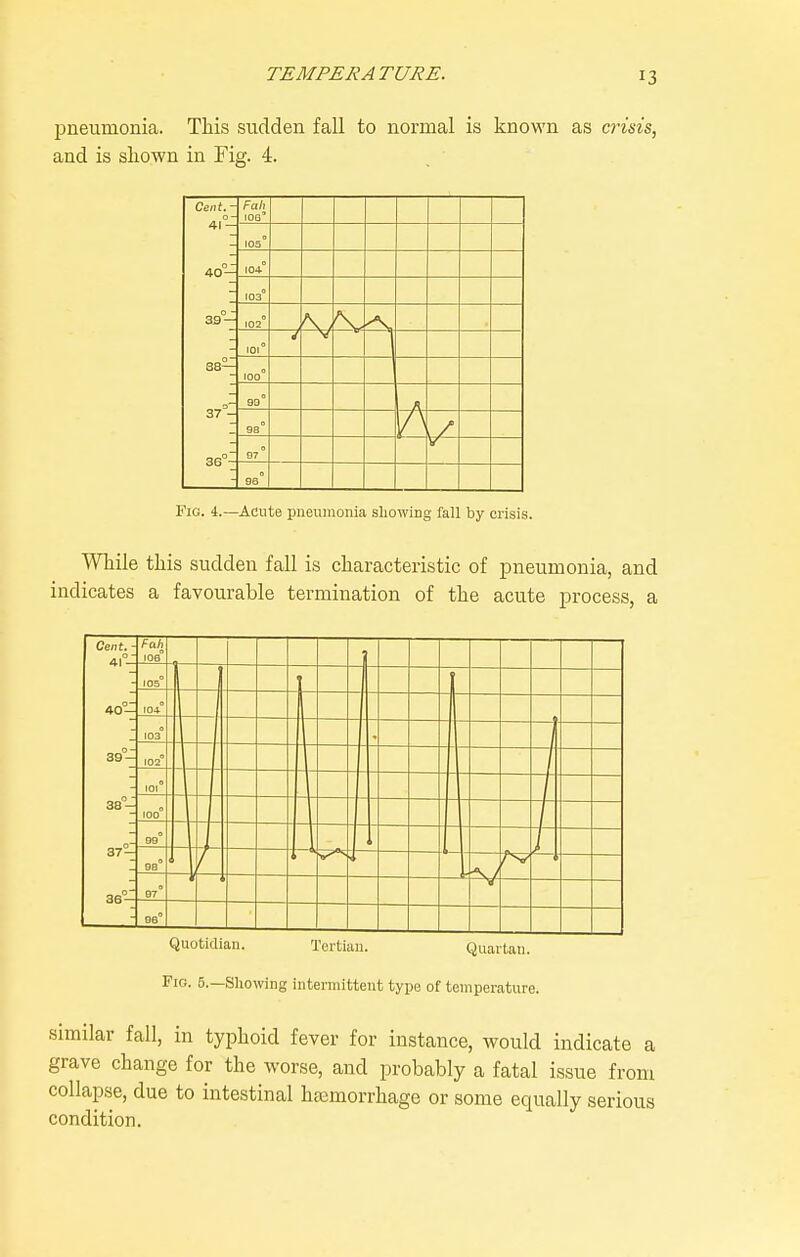 pneumonia. This sudden fall to normal is known as crisis, and is sliown in Fig. 4. Cent. - 0 - 4J — 40- Fah ioq' 105 104 39°- 102 -A, 38^ 37=: 101° 100° 93° 98° 97° 96° Fig. 4.—Acute pneumonia showing fall by crisis. While this sudden fall is characteristic of pneumonia, and indicates a favourable termination of the acute process, a Cent. - 4I''- Fah 106° 105° I 40°- IOi° 103 39°-: 102° 1 t 101° 38°- 100° 37°-^ 99° 93° 36°' 97° 96° Quotidian. Tertian. Quartan. Fig. 5.—Slio\ving intermittent type of temperature. similar fall, in typhoid fever for instance, would indicate a grave change for the worse, and probably a fatal issue from collapse, due to intestinal haemorrhage or some equally serious condition.