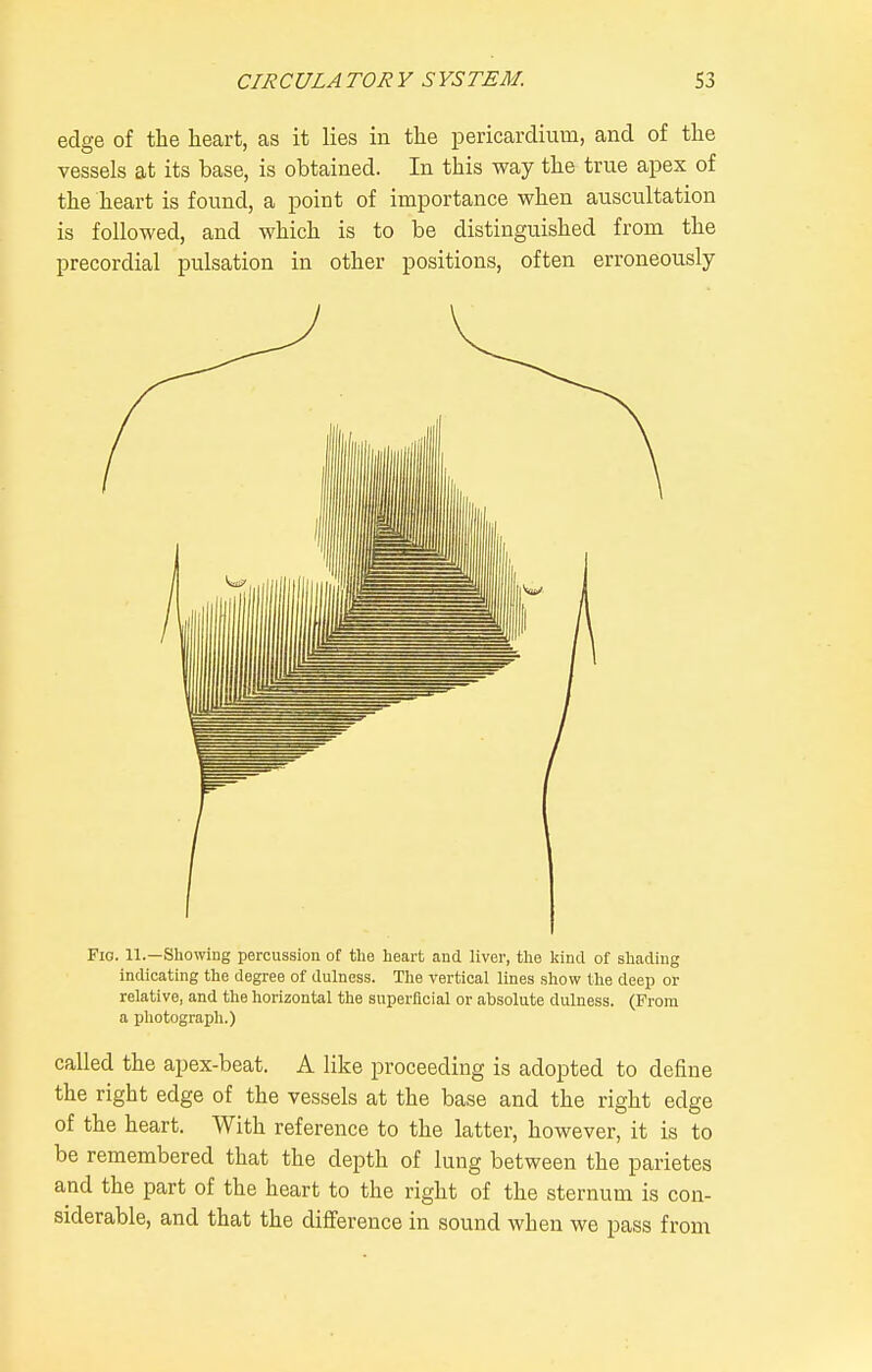 edge of tlie heart, as it lies in the pericardium, and of the vessels at its base, is obtained. In this way the true apex of the heart is found, a point of importance when auscultation is followed, and which is to be distinguished from the precordial pulsation in other positions, often erroneously Fig. 11.—Showing percussion of the heart and liver, the Itincl of shading indicating the degree of dulness. The vertical lines show the deep or relative, and the horizontal the snperflcial or absolute dulness. (From a photograph.) called the apex-beat. A like proceeding is adopted to define the right edge of the vessels at the base and the right edge of the heart. With reference to the latter, however, it is to be remembered that the depth of lung between the parietes and the part of the heart to the right of the sternum is con- siderable, and that the difiference in sound when we pass from