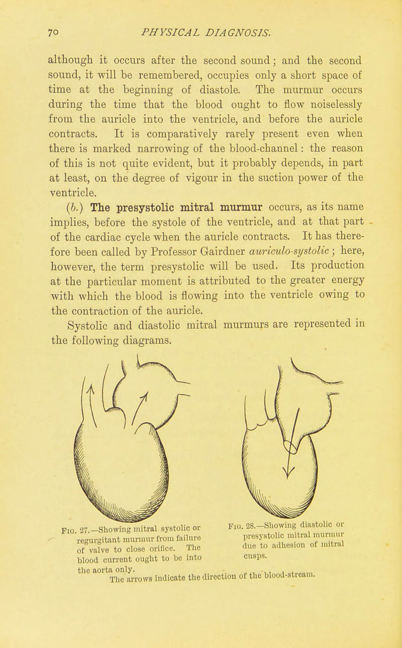 although it occurs after the second sound; and the second sound, it will be remembered, occupies only a short space of time at the beginning of diastole. The murmur occurs during the time that the blood ought to flow noiselessly from the auricle into the ventricle, and before the auricle contracts. It is comparatively rarely present even when there is marked narrowing of the blood-channel: the reason of this is not quite evident, but it probably depends, in part at least, on the degree of vigour in the suction power of the ventricle. (6.) The presystolic mitral murmur occurs, as its name implies, before the systole of the ventricle, and at that part - of the cardiac cycle when the auricle contracts. It has there- fore been called by Professor Gairdner auriculo-systolic; here, however, the term presystolic will be used. Its production at the particular moment is attributed to the greater energy with which the blood is flowing into the ventricle owing to the contraction of the auricle. Systolic and diastolic mitral murmurs are represented in the following diagrams. Fio. 27.-Showmg mitral systolic or Fio. 2S.-Sl.ow.ns diastolic or regurgitant mur.nur from failure presystolic mitral munm.r of vaTve to close orillce. The duo to adl.esion of mitral blood current ought to be into cusps, tlic aorta only. , ■,, , ■ The arrows indicate the direction of the blood-stream.